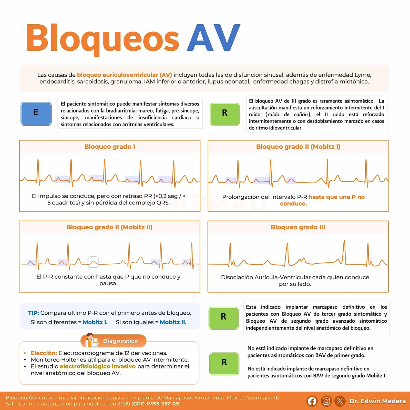 Bloqueos AV