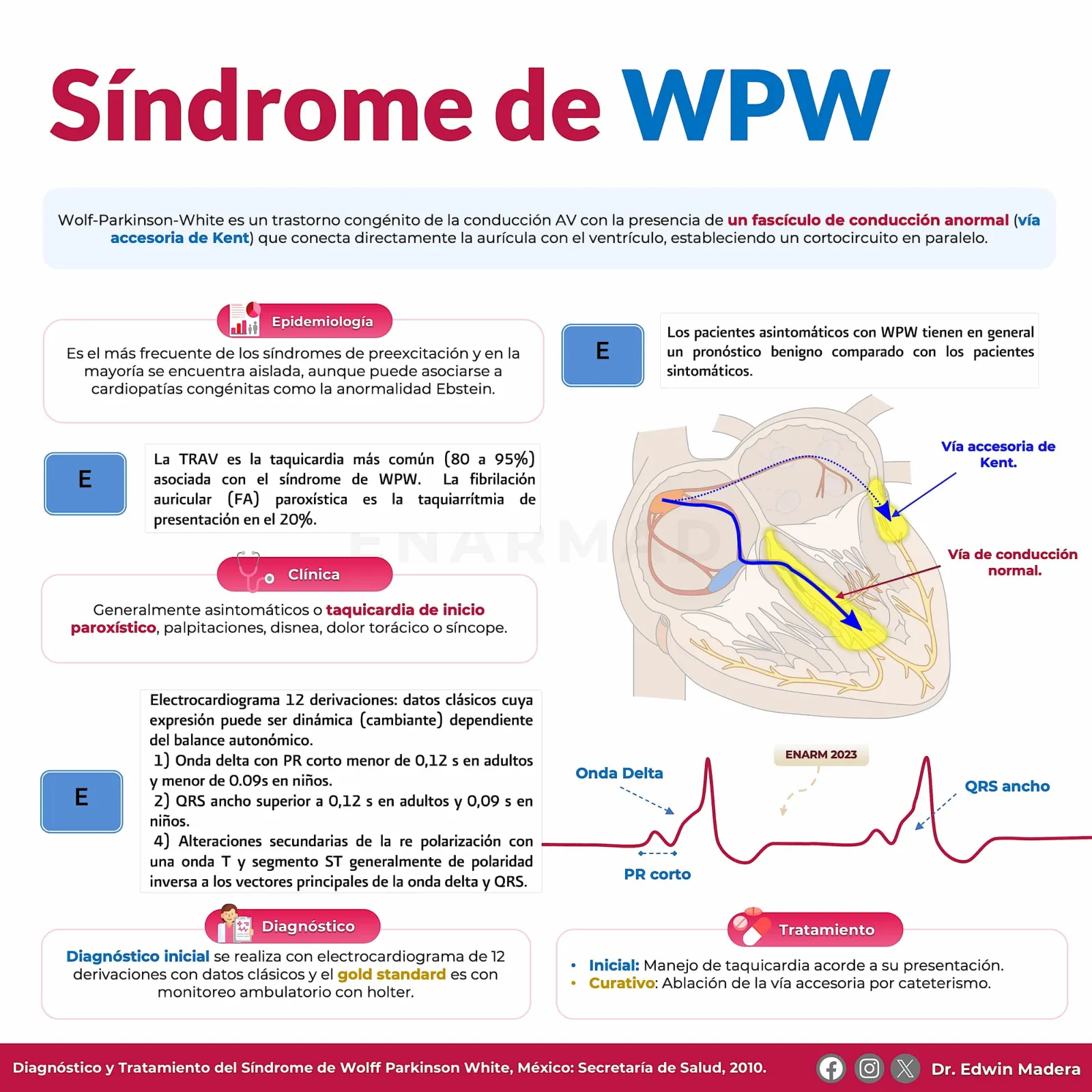 Síndrome de WPW