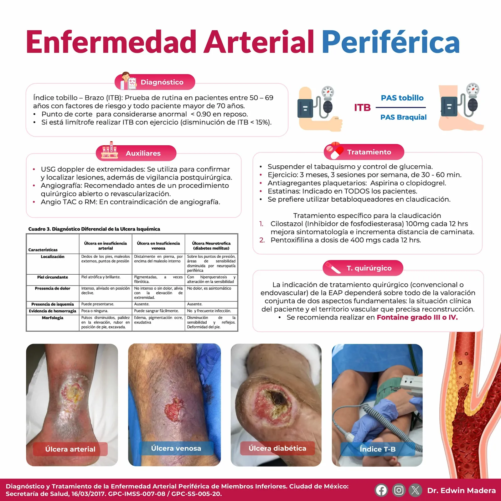 Enfermedad arterial periférica