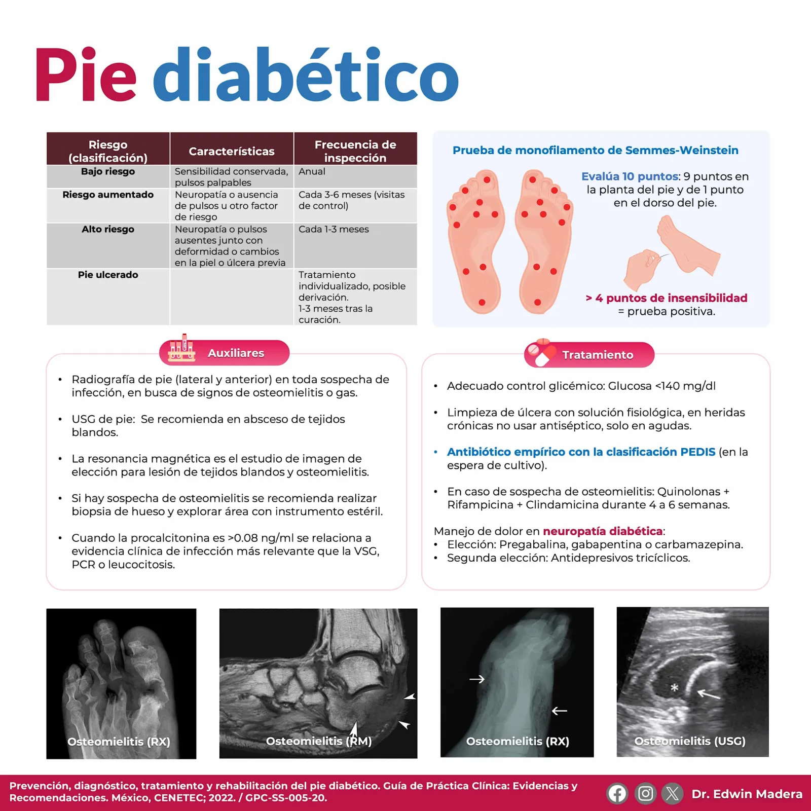 Pie diabético