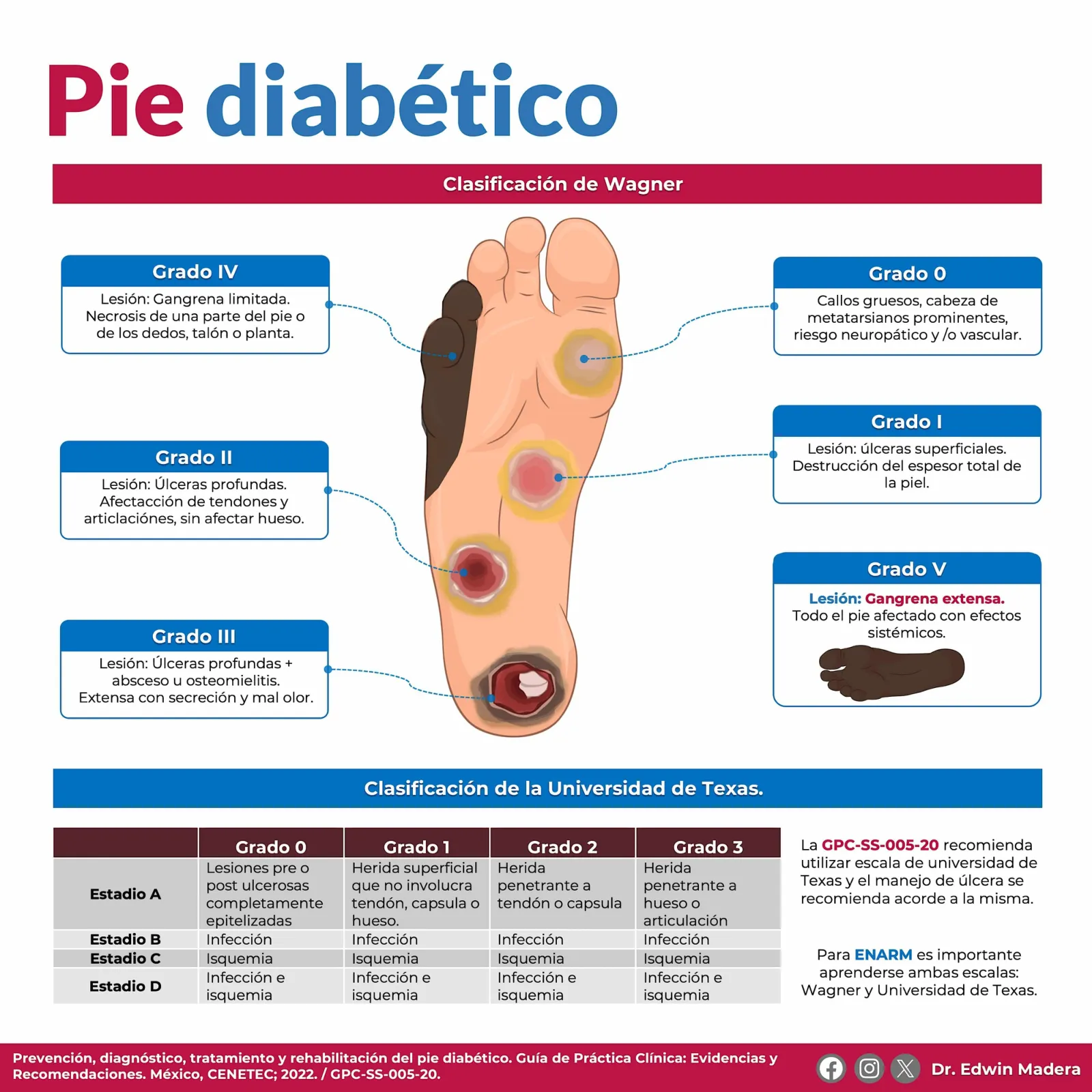 Pie diabético