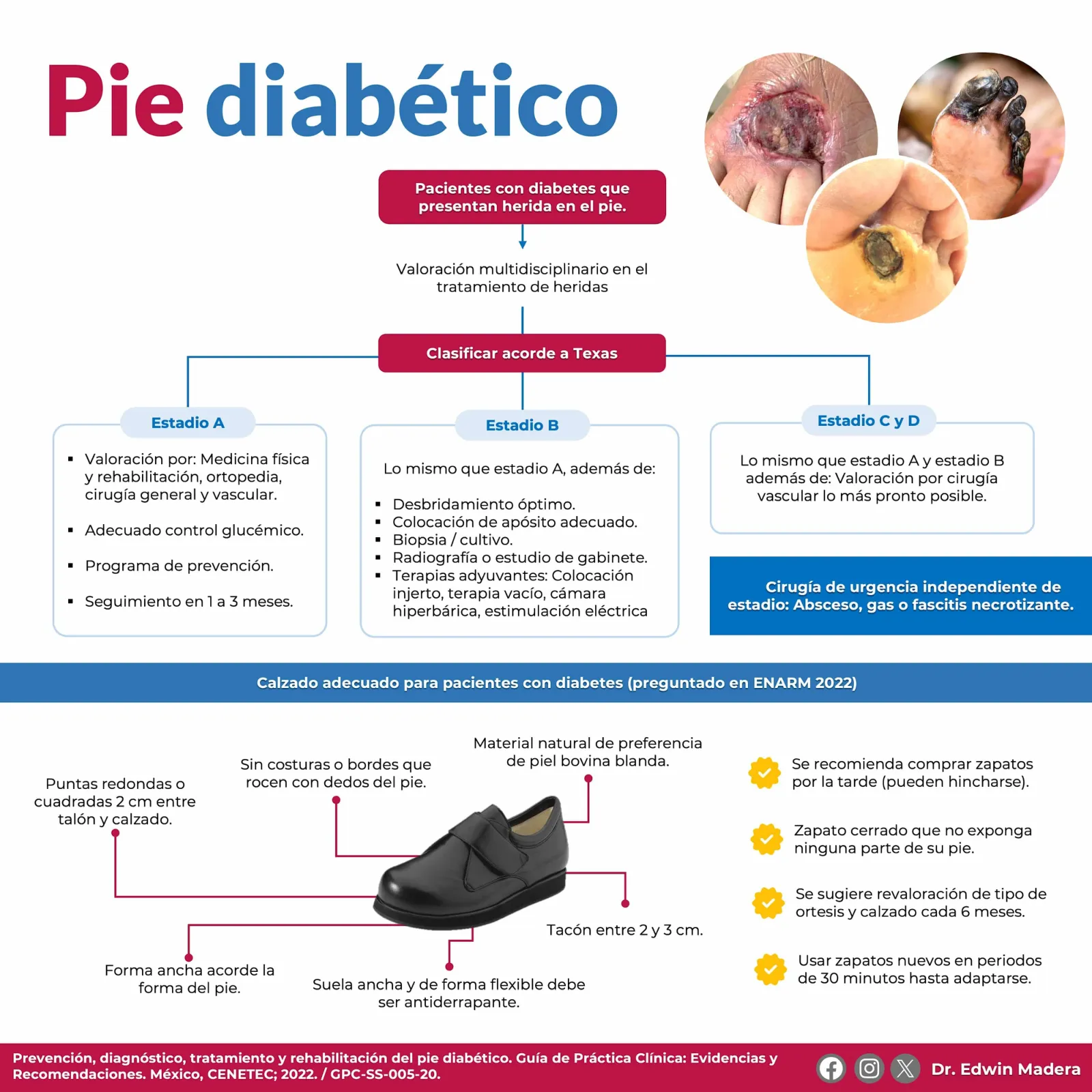 Pie diabético