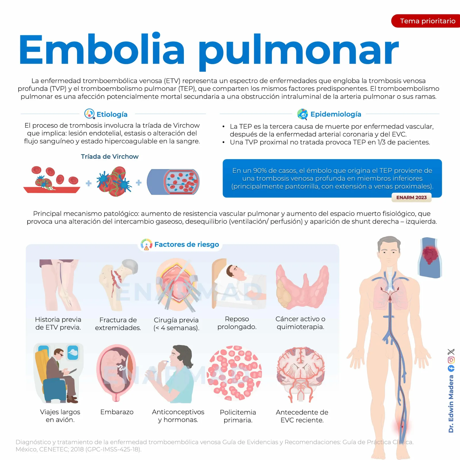 Tromboembolia pulmonar