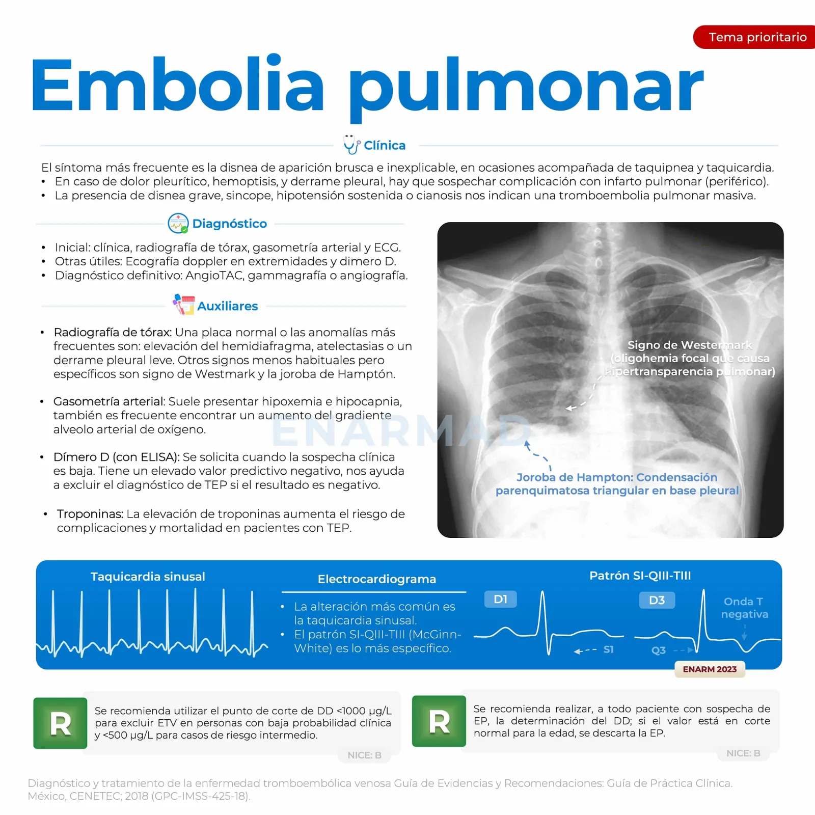 Tromboembolia pulmonar