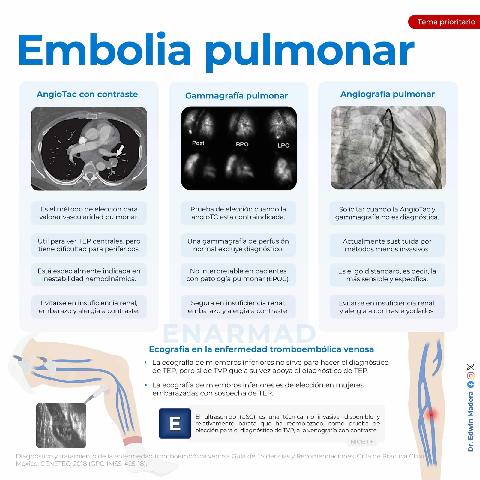 Tromboembolia pulmonar
