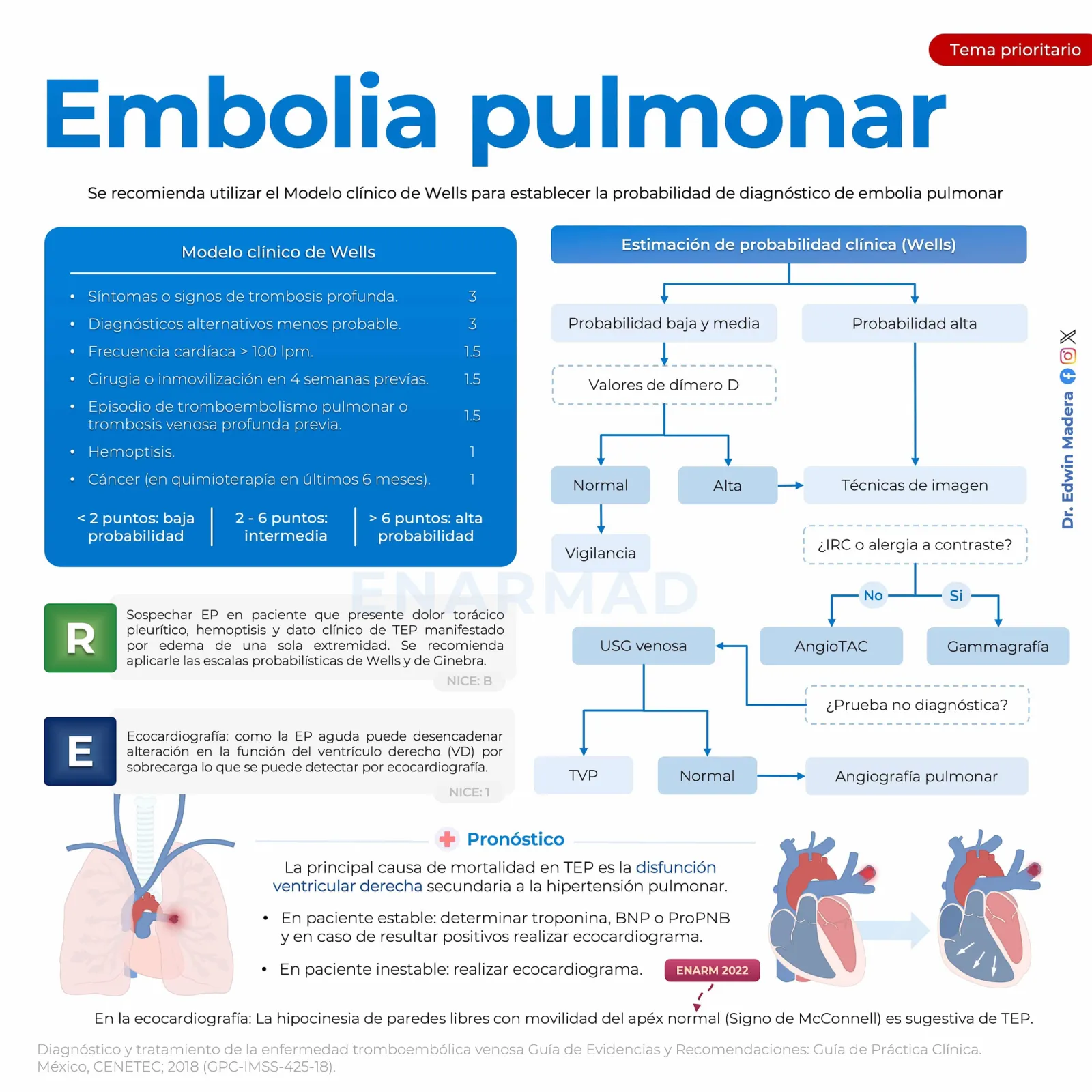 Tromboembolia pulmonar