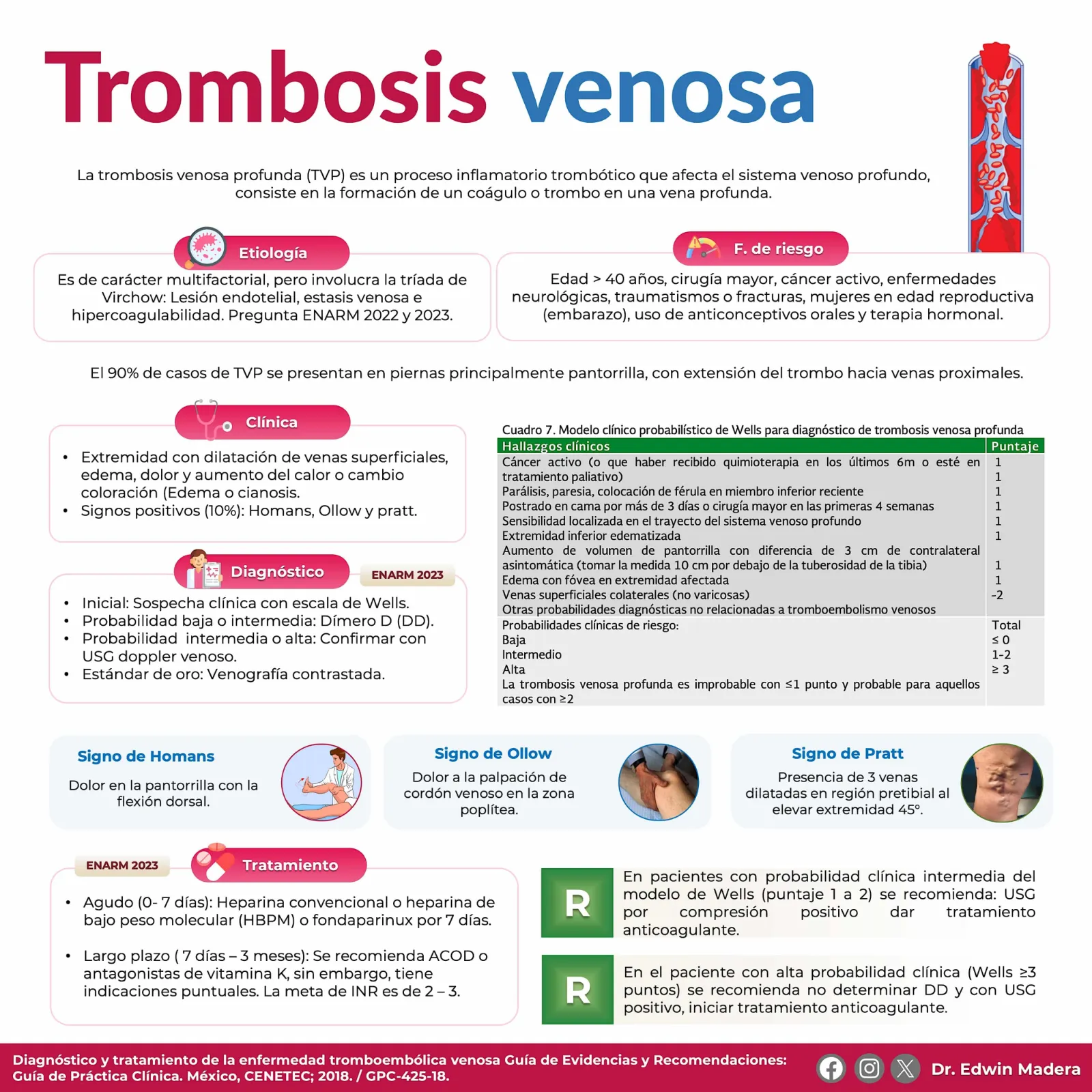 Trombosis venosa profunda