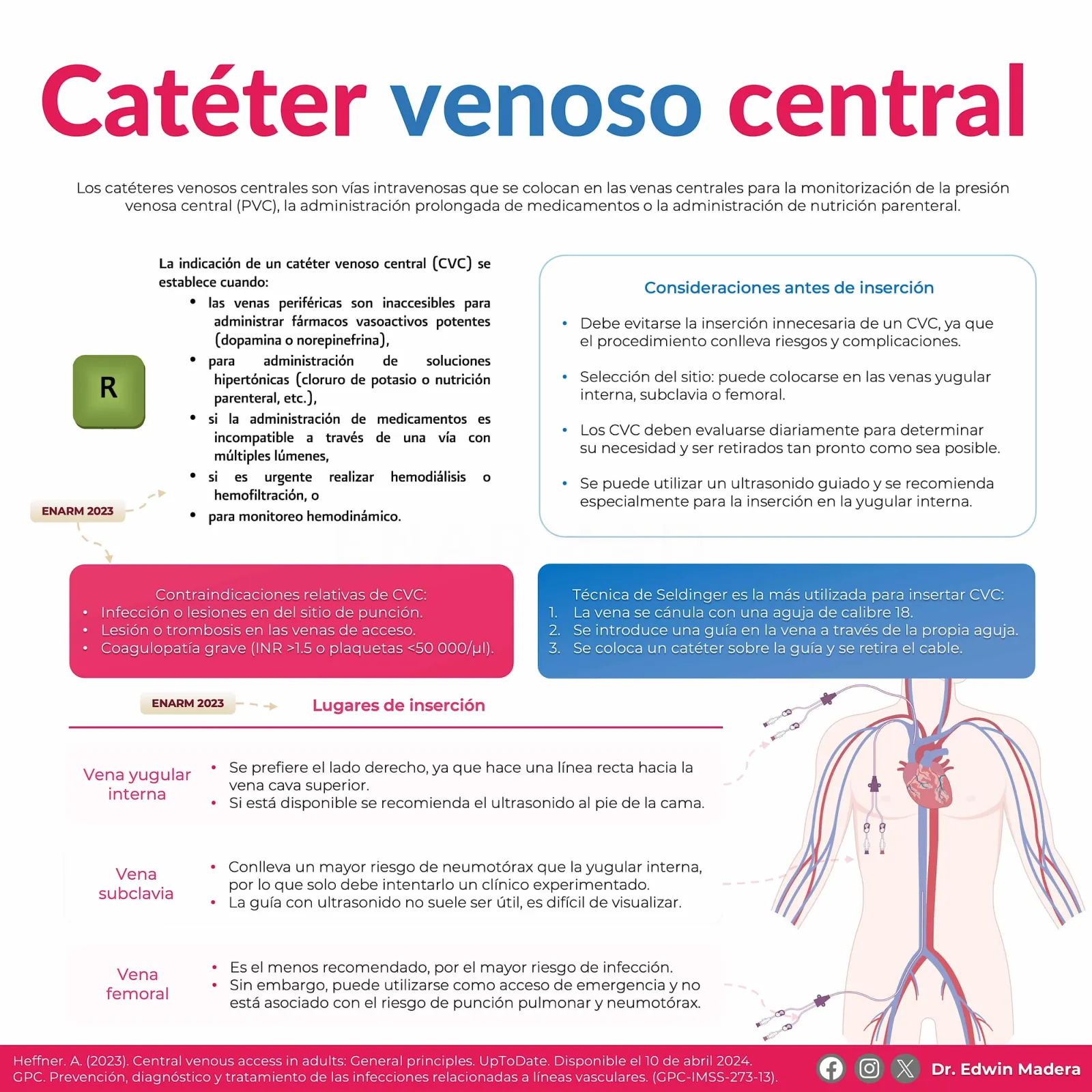 Catéter venoso central