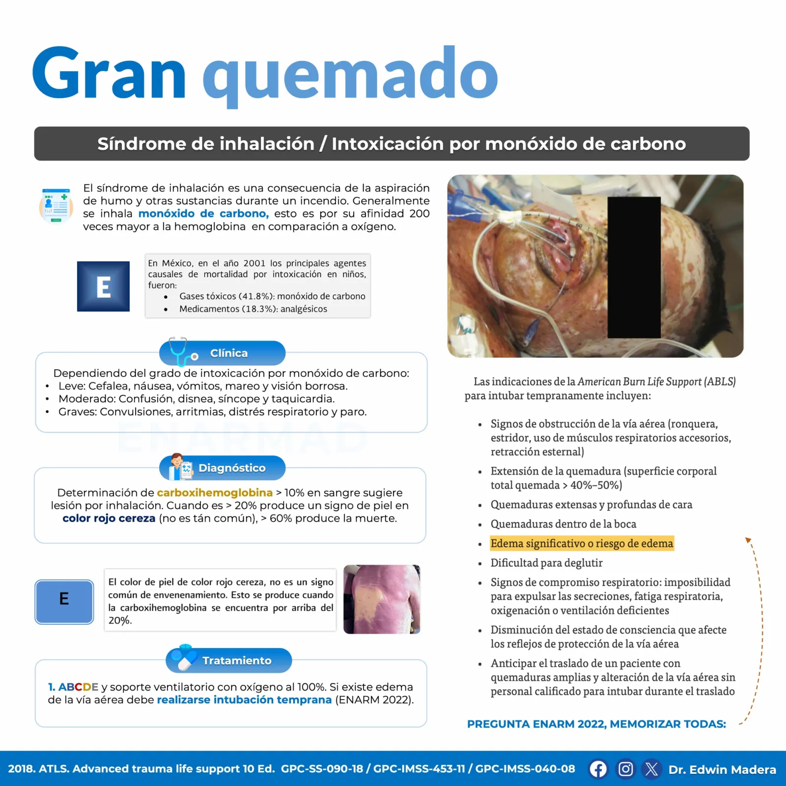 Gran quemado