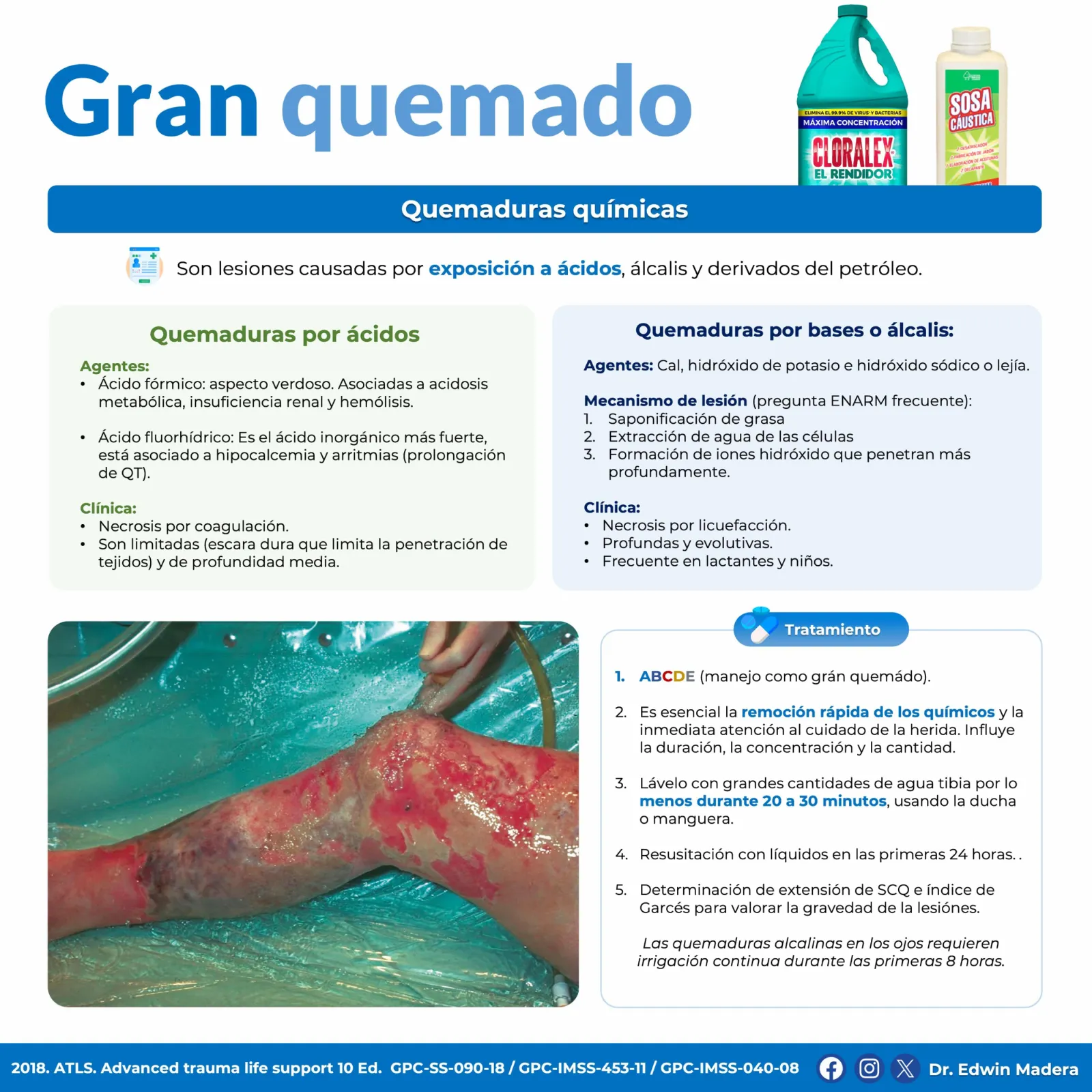 Gran quemado