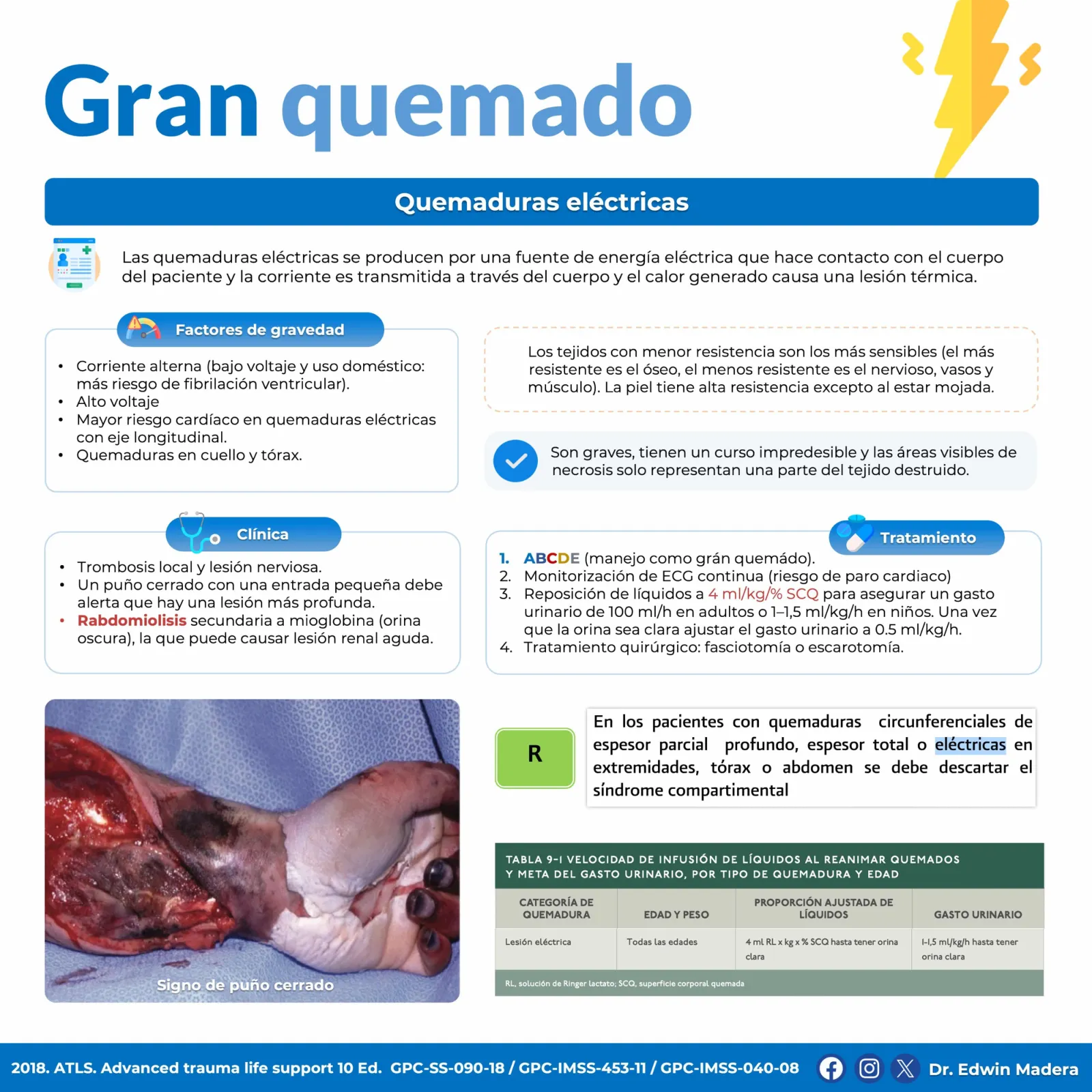 Gran quemado