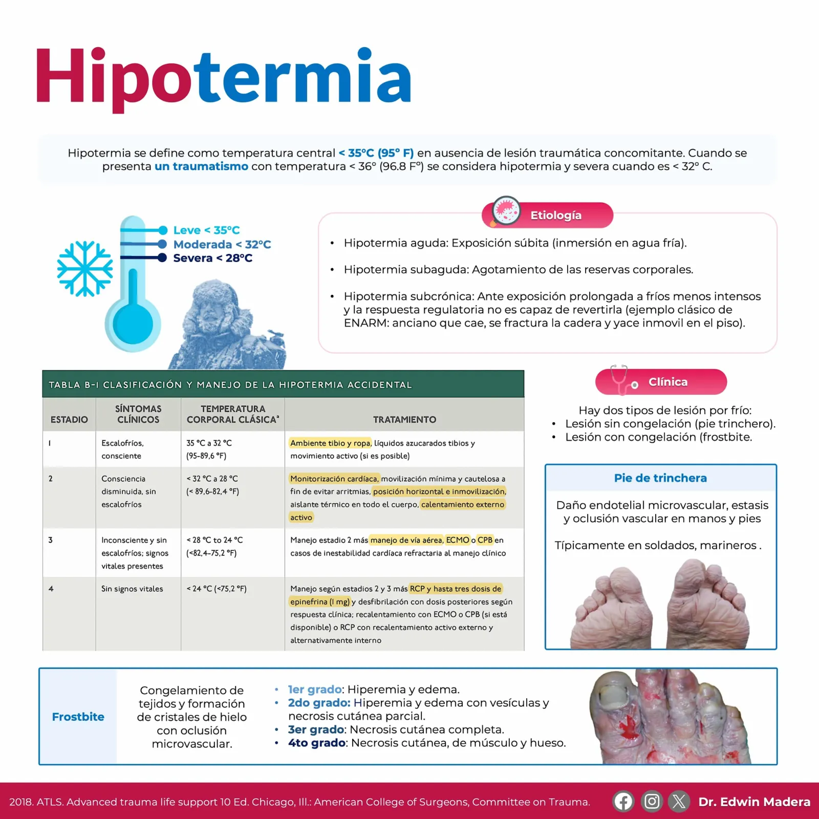 Hipotermia