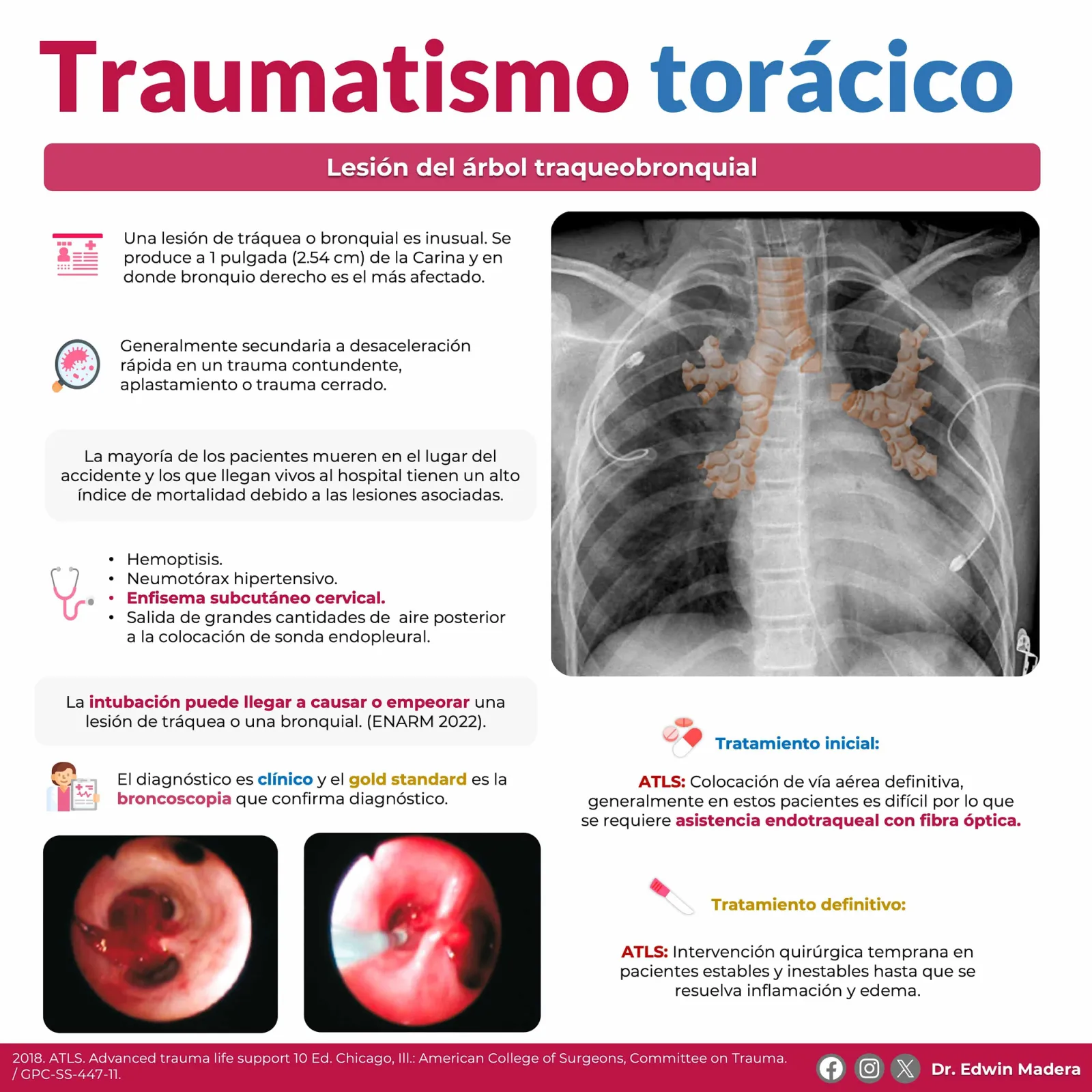 Lesión traqueobronquial