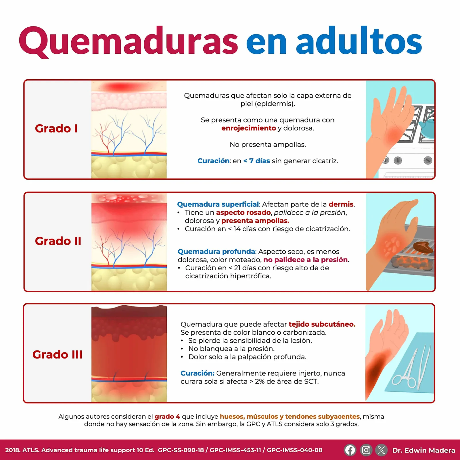 Quemaduras