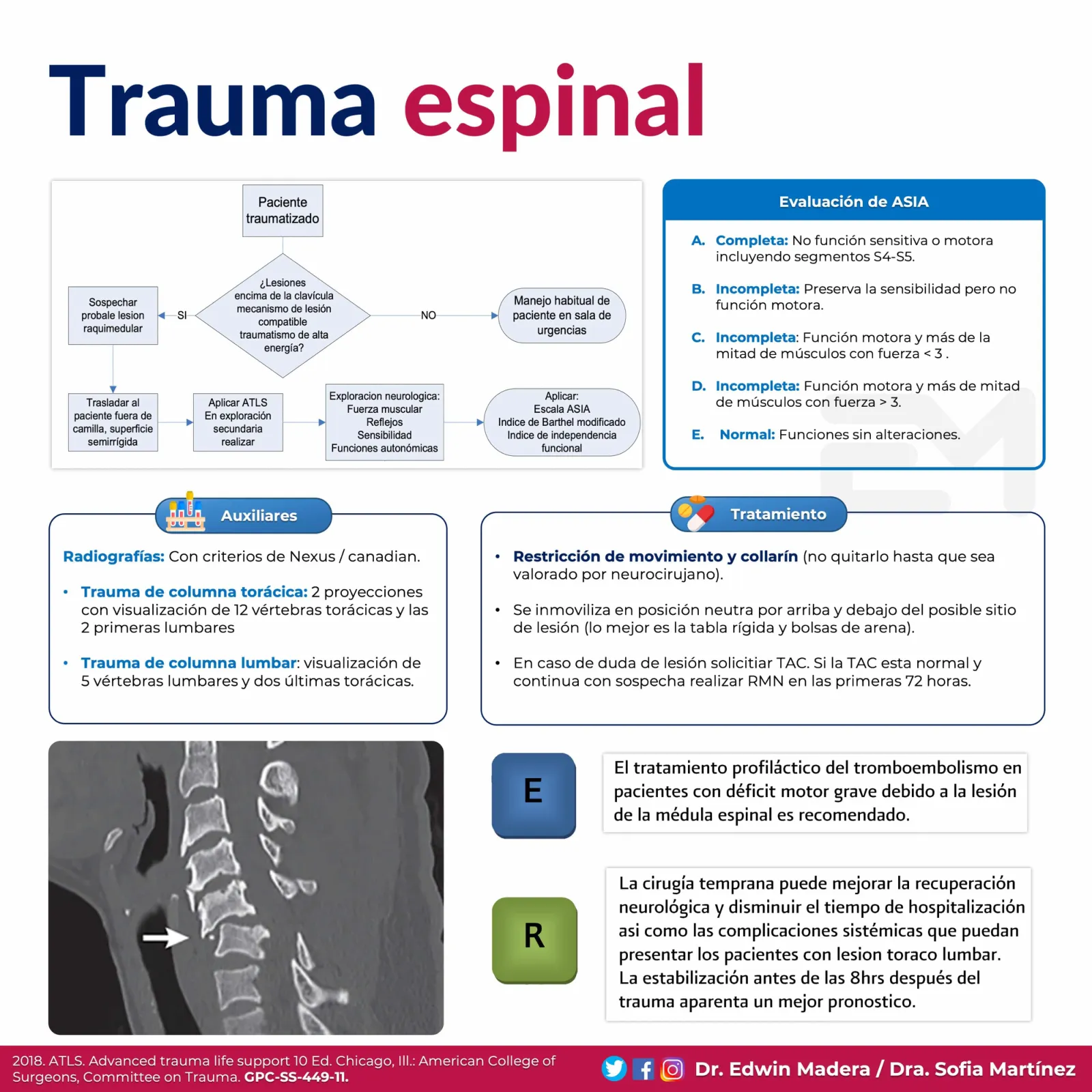 Trauma espinal