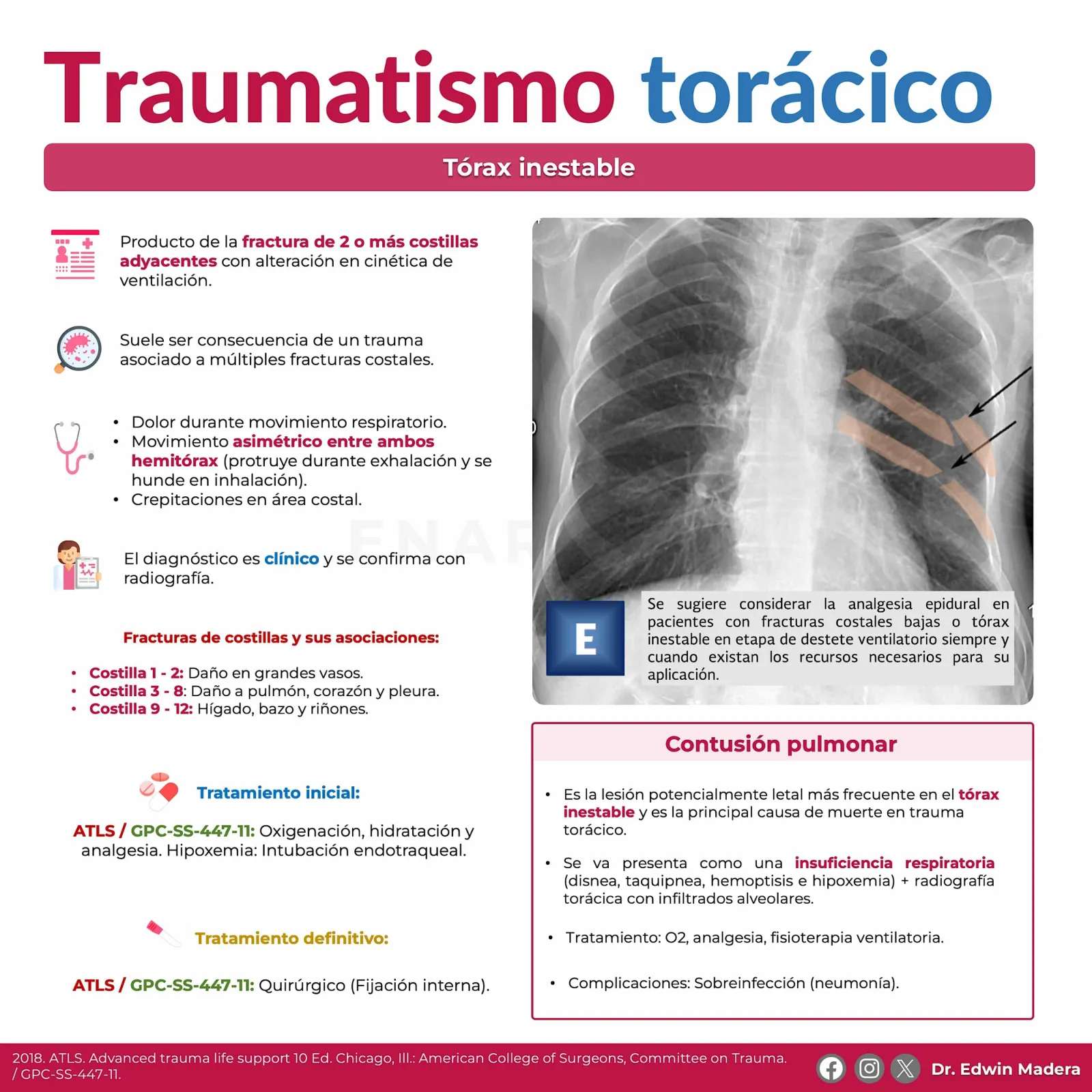 Trauma torácico
