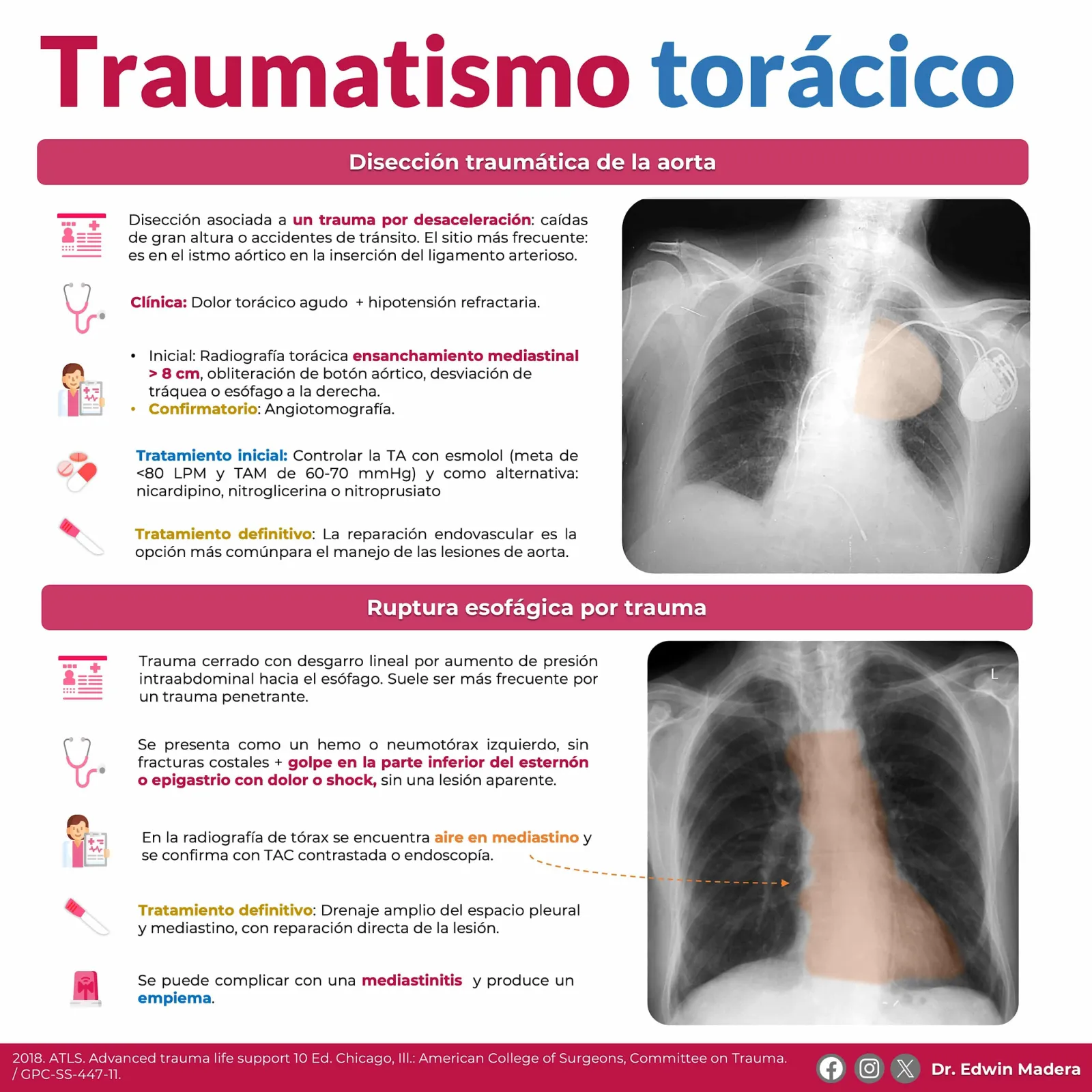 Trauma torácico