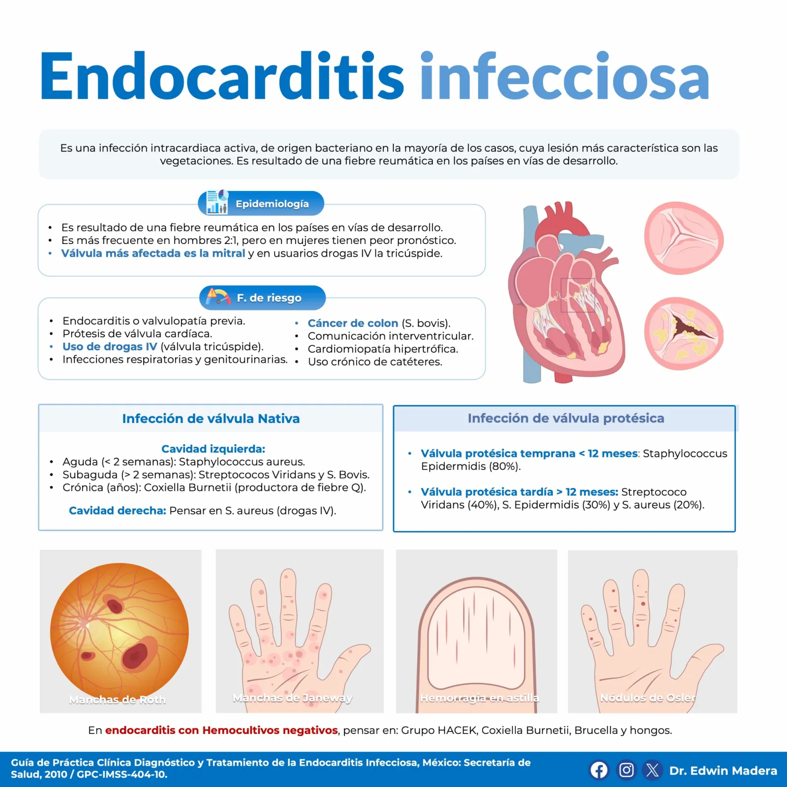 Endocarditis infecciosa