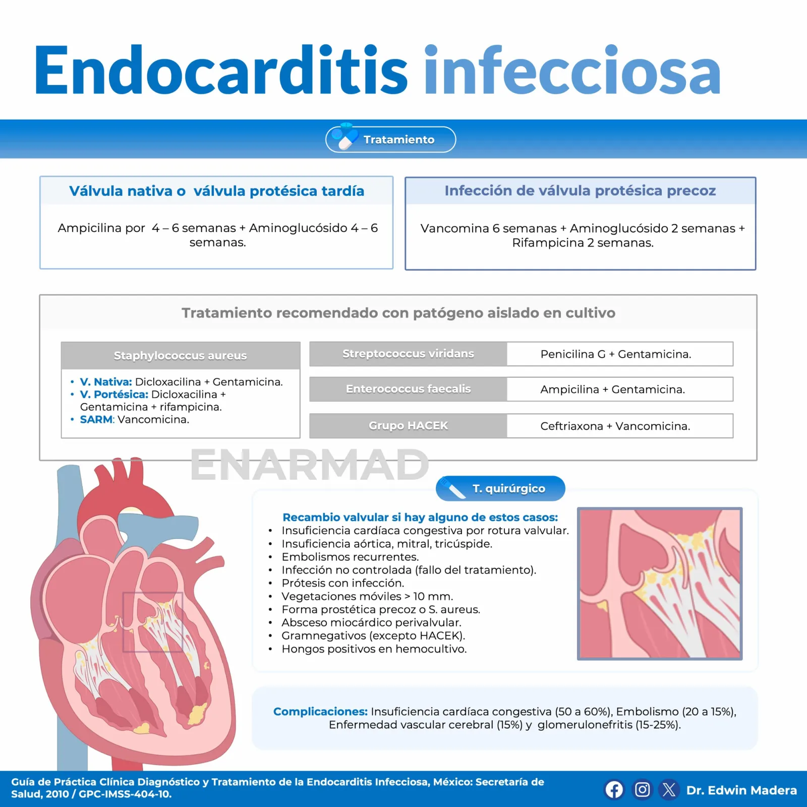 Endocarditis infecciosa