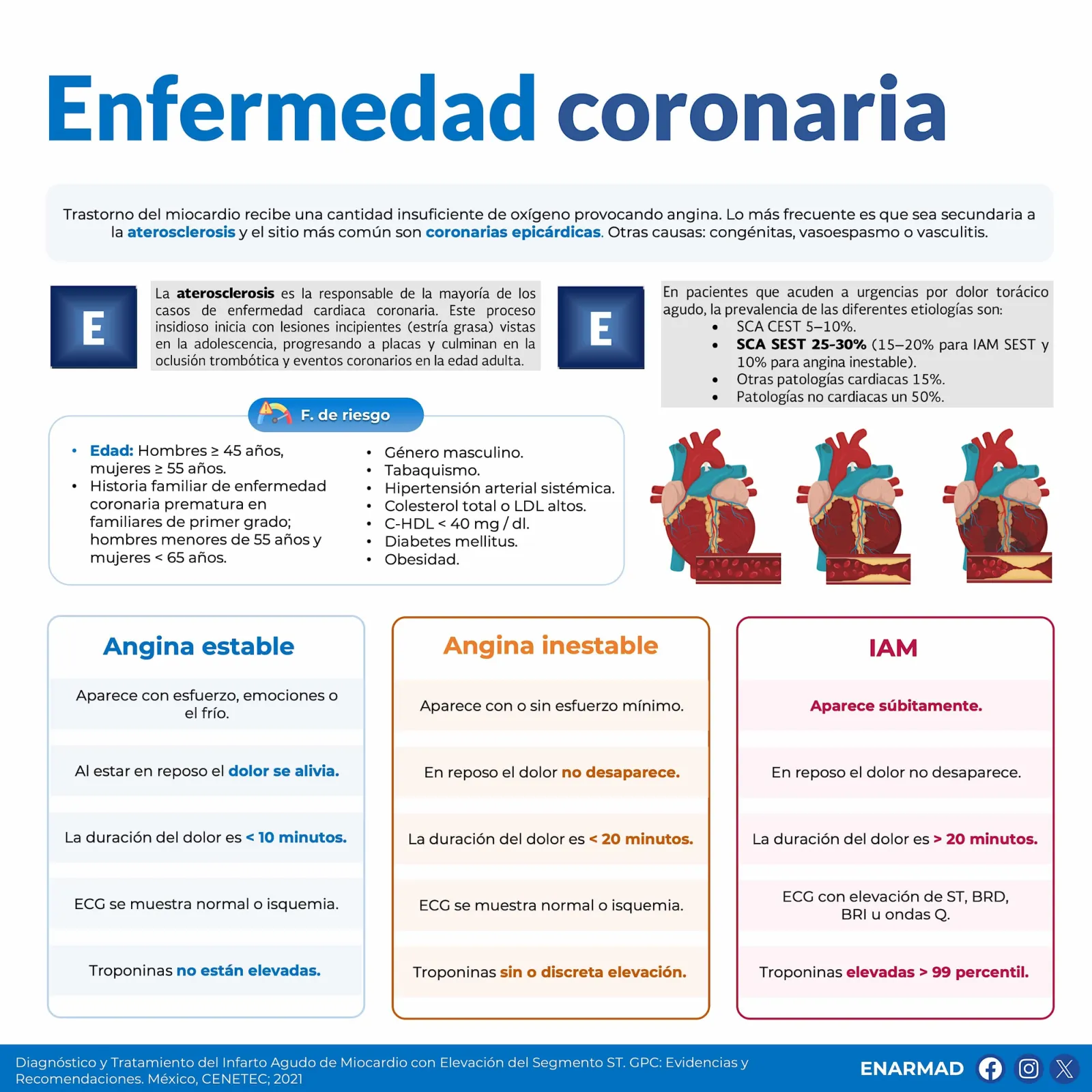 Enfermedad coronaria