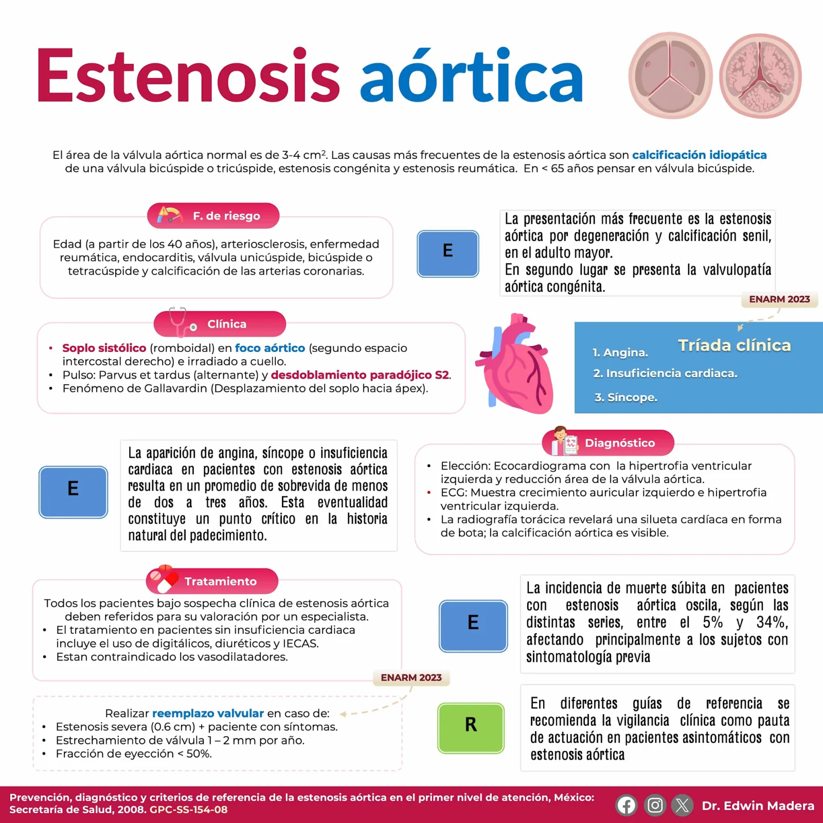 Estenosis aórtica