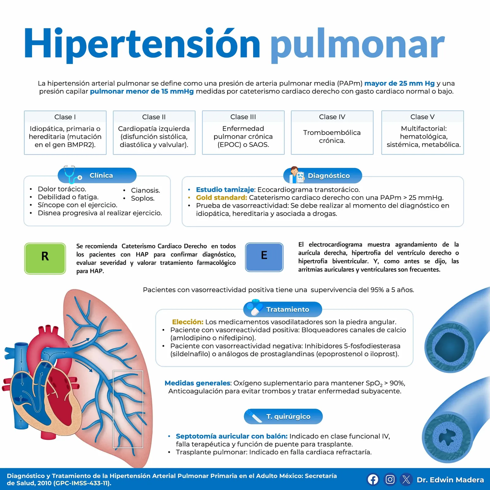 Hipertensión pulmonar