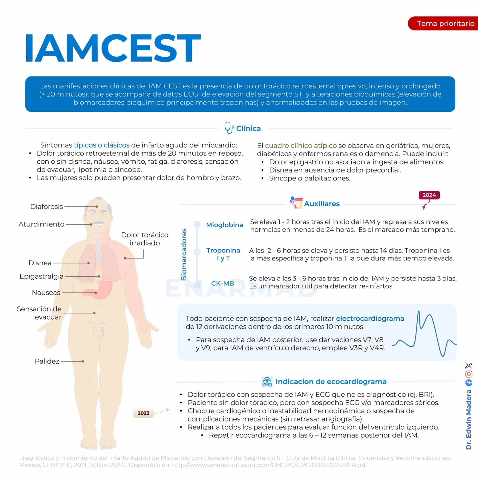 Infarto agudo de miocardio