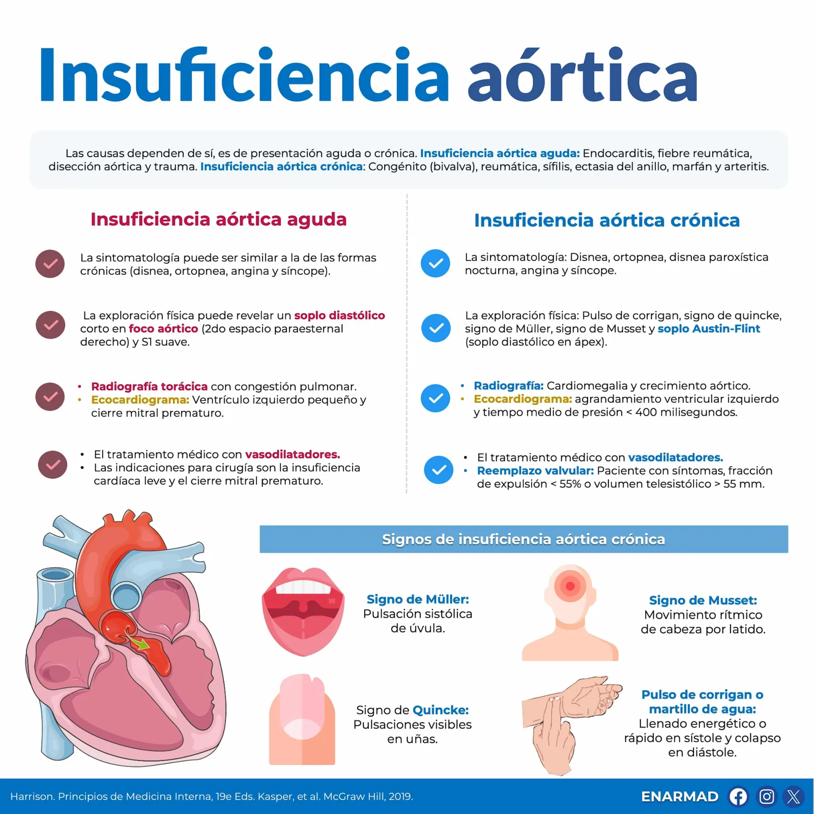Insuficiencia aórtica
