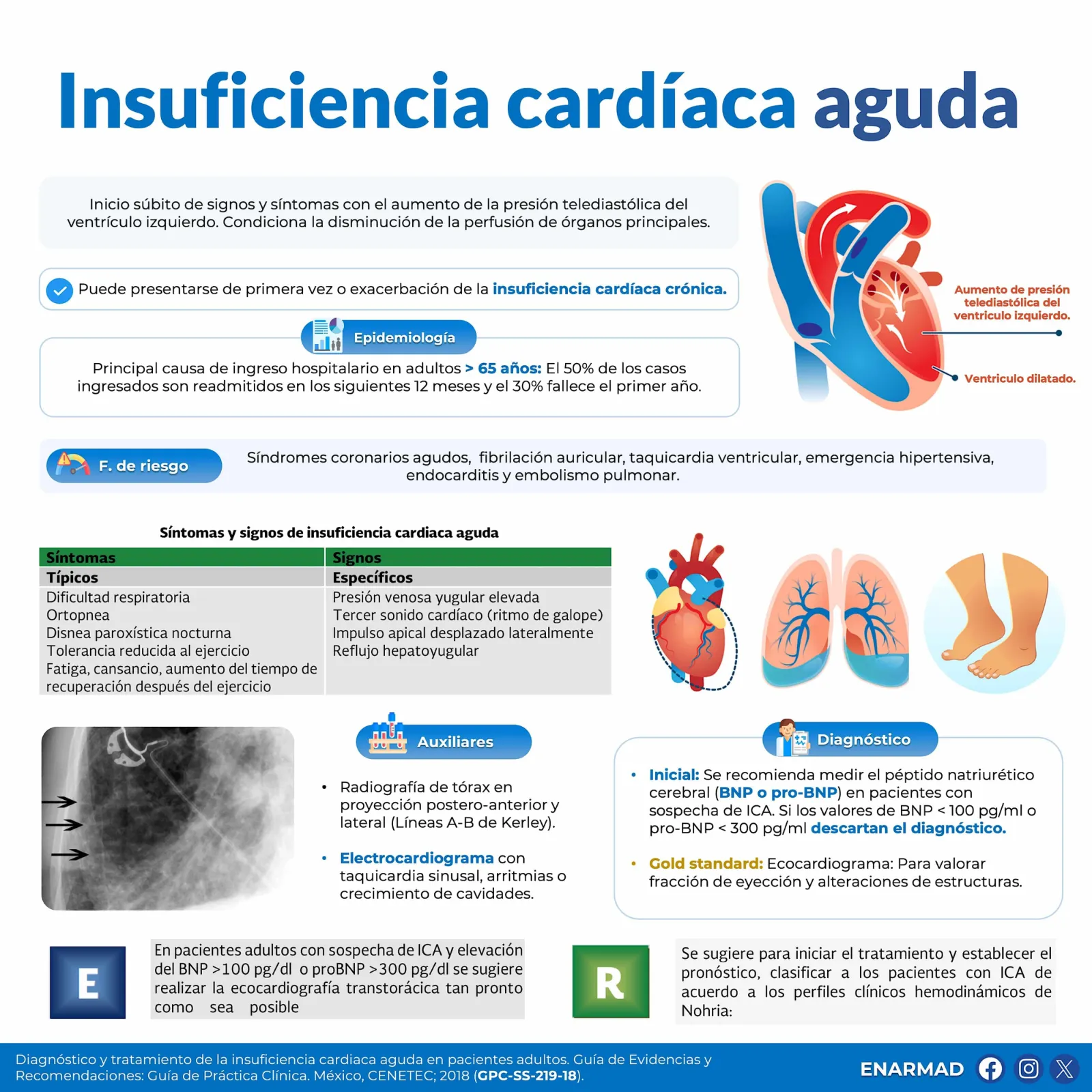 Insuficiencia cardíaca aguda