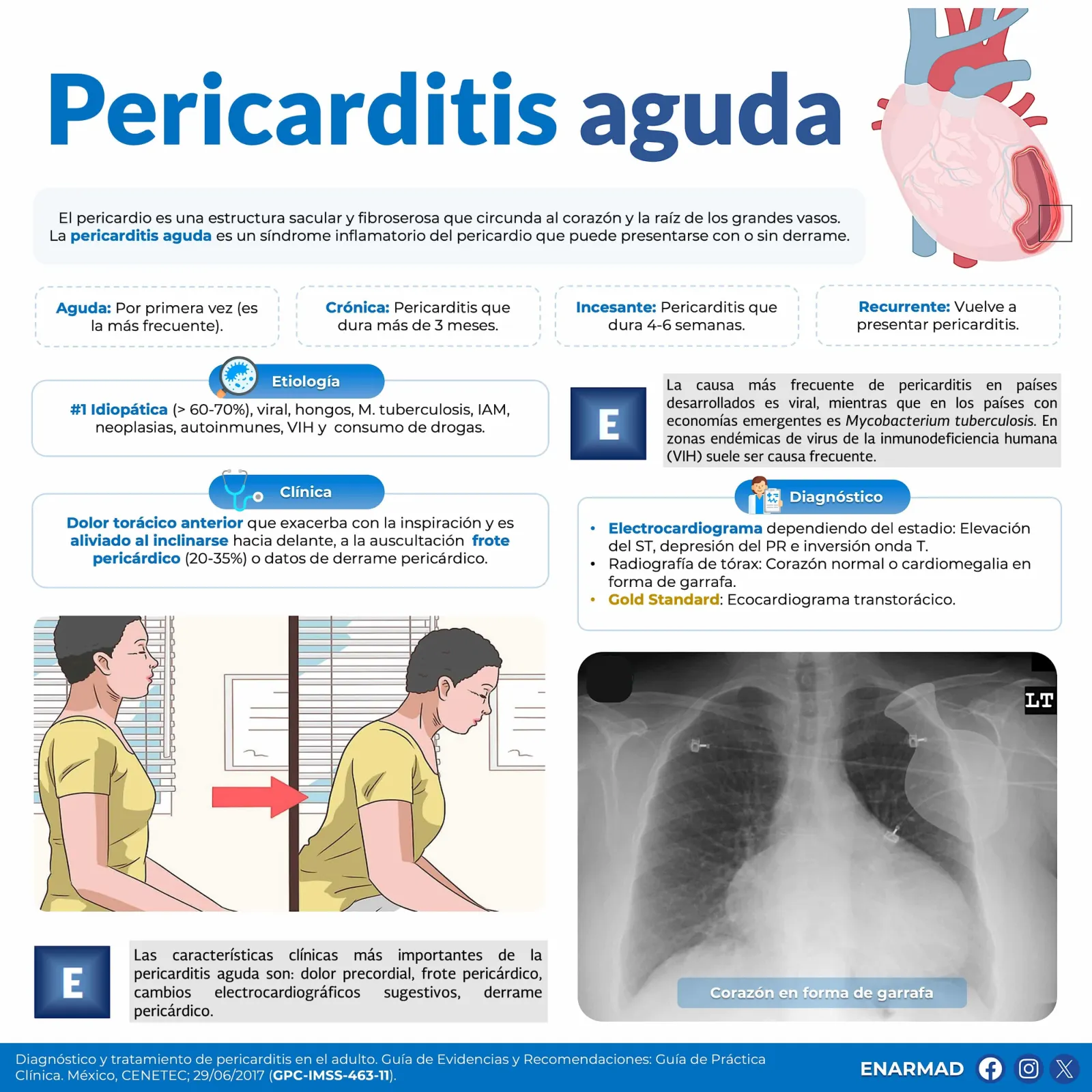 Pericarditis