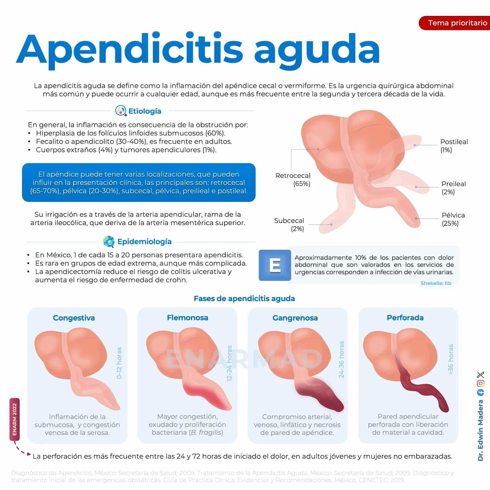 Apendicitis aguda