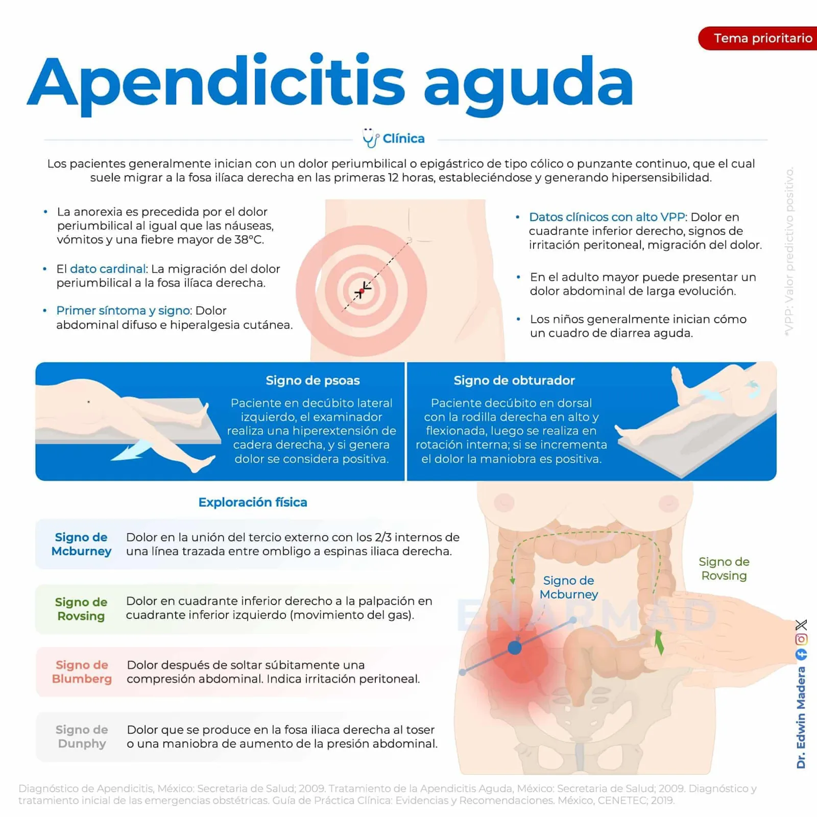 Apendicitis aguda