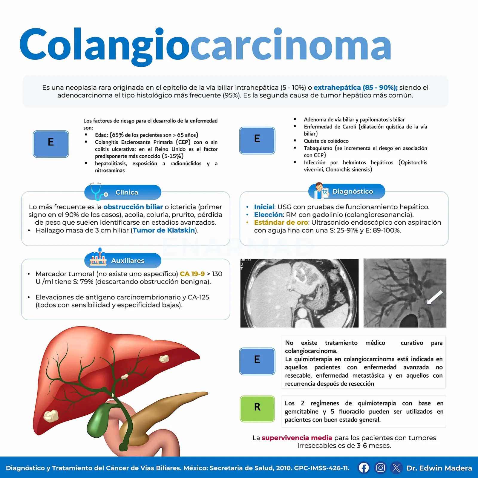 Colangiocarcinoma