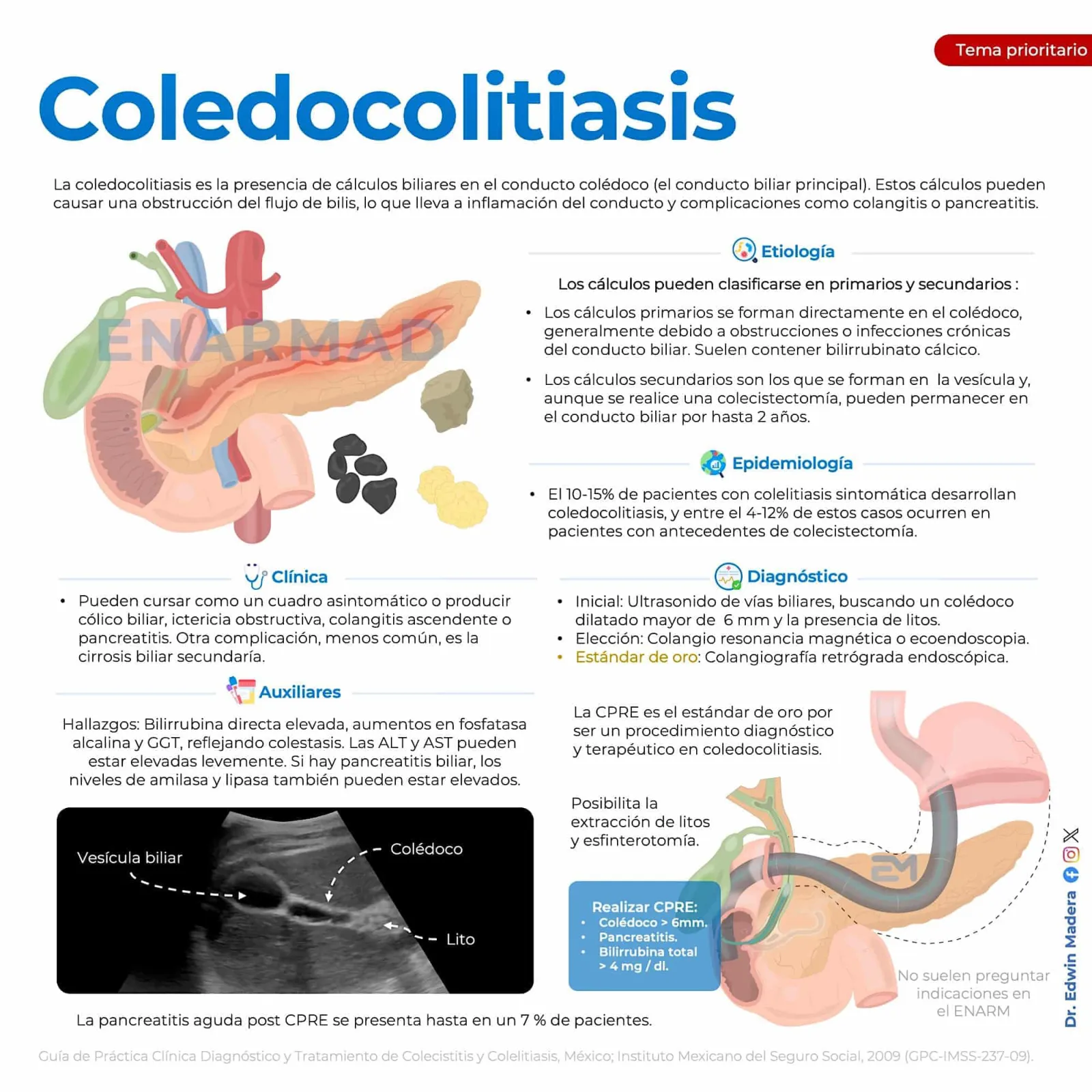 Coledocolitiasis