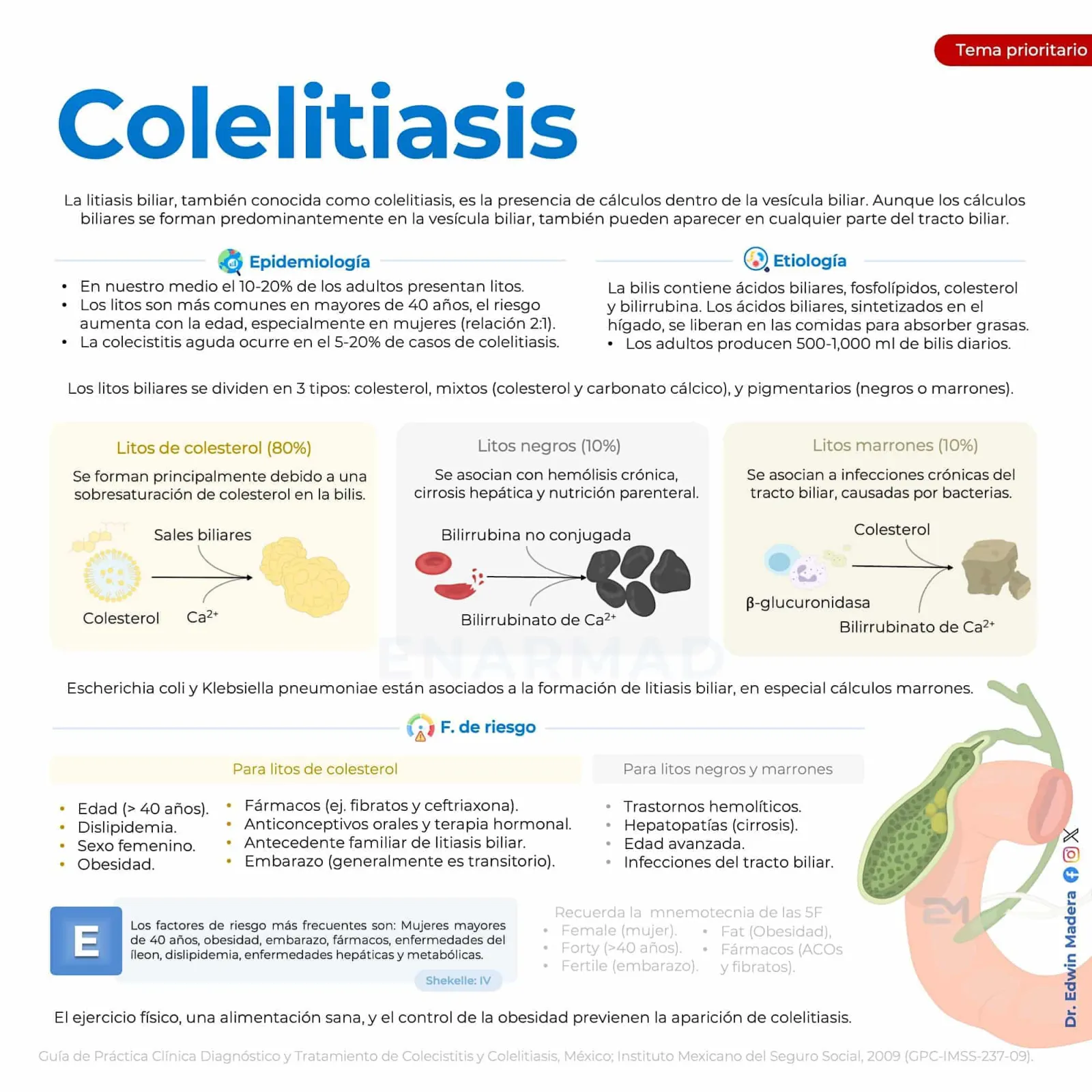 Colelitiasis