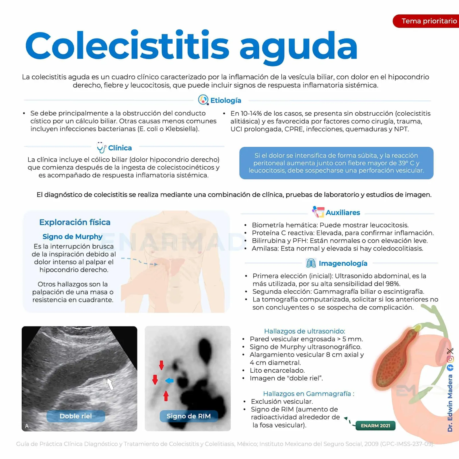 Colelitiasis