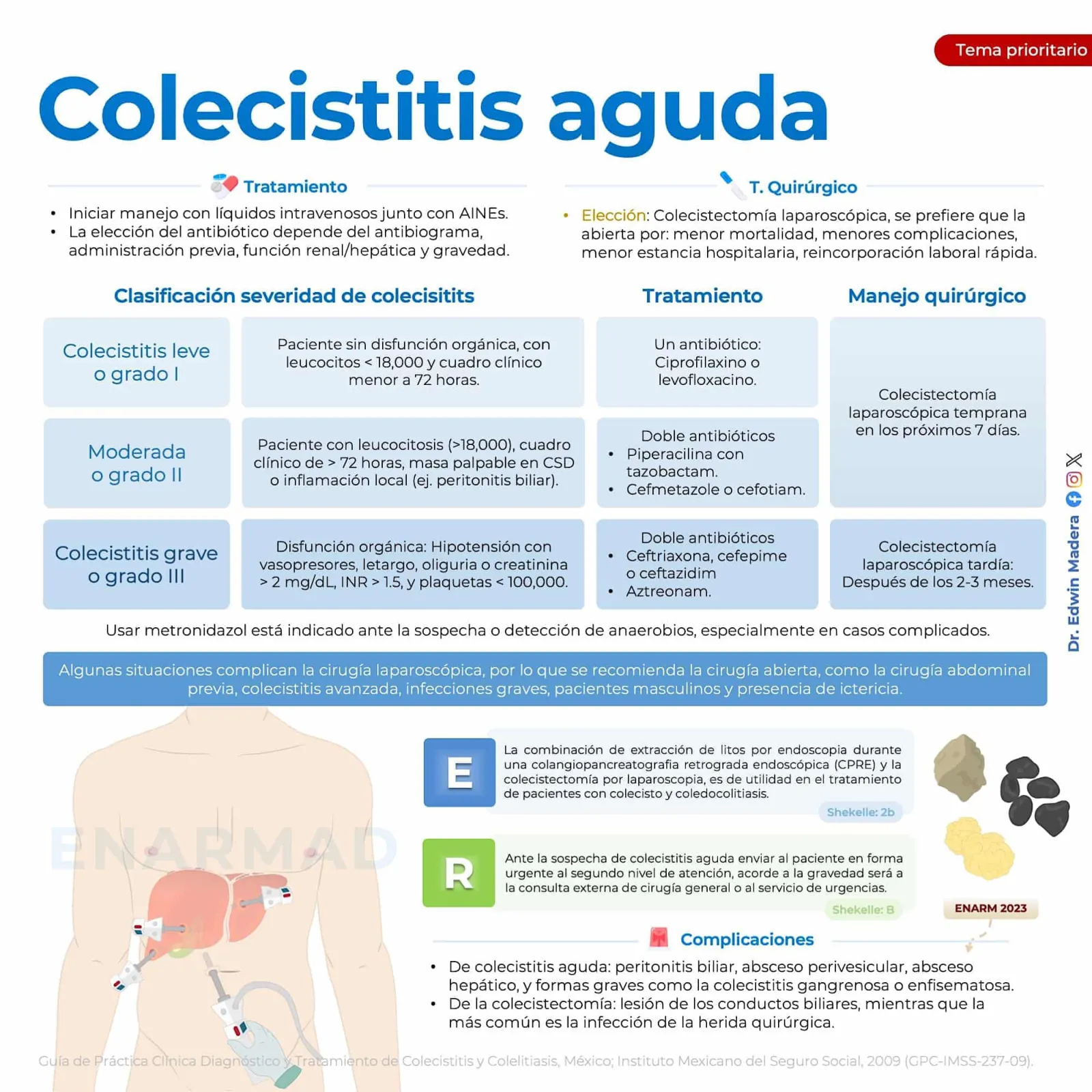 Colelitiasis