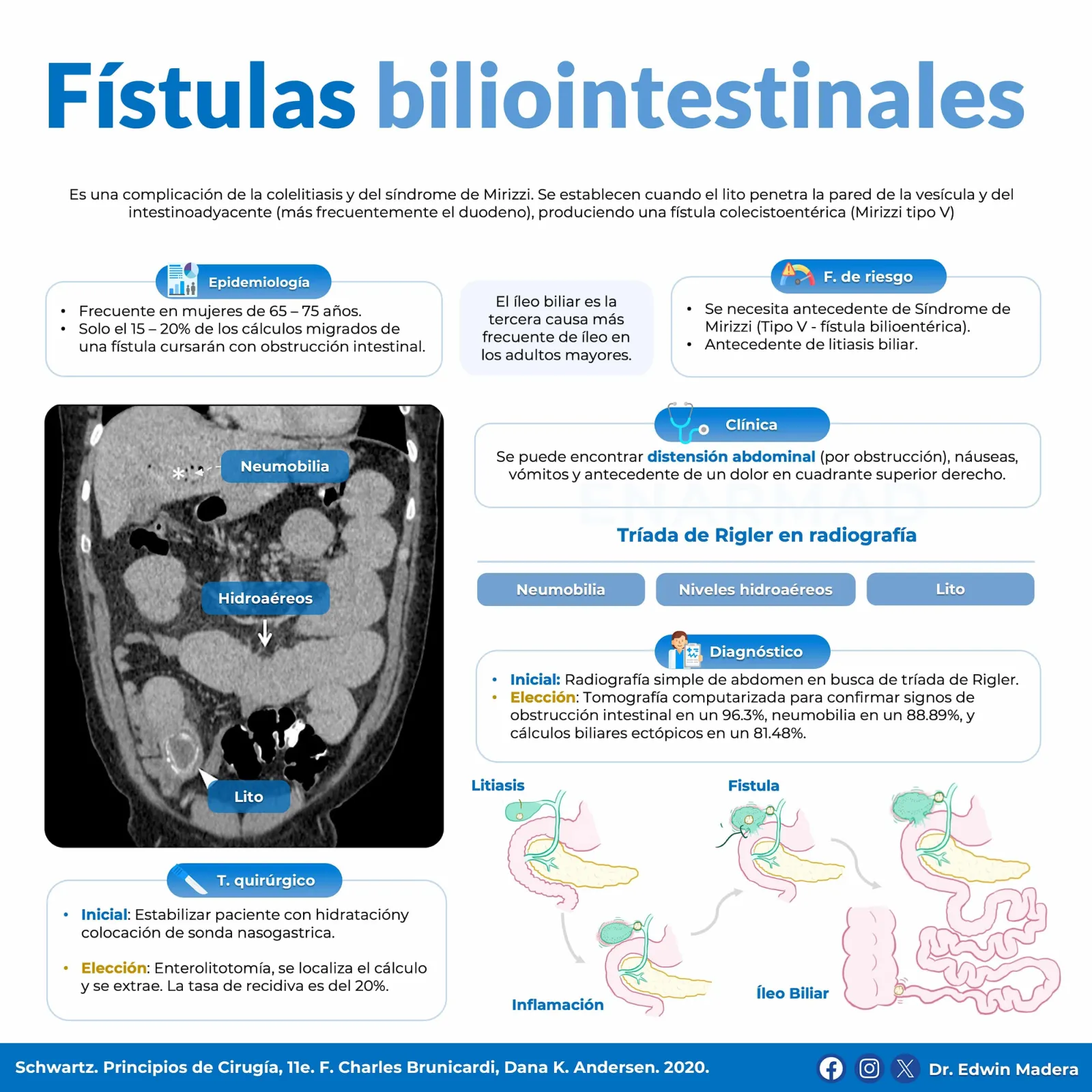 Fístulas biliointestinales