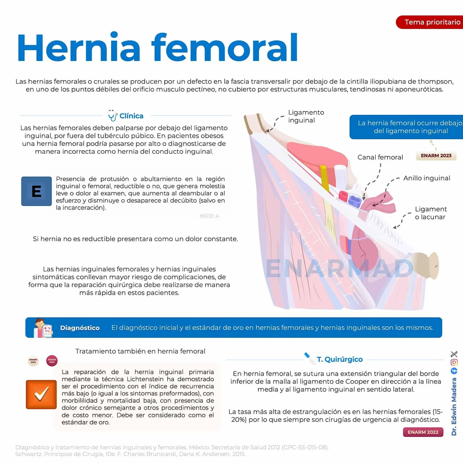 Hernia femoral