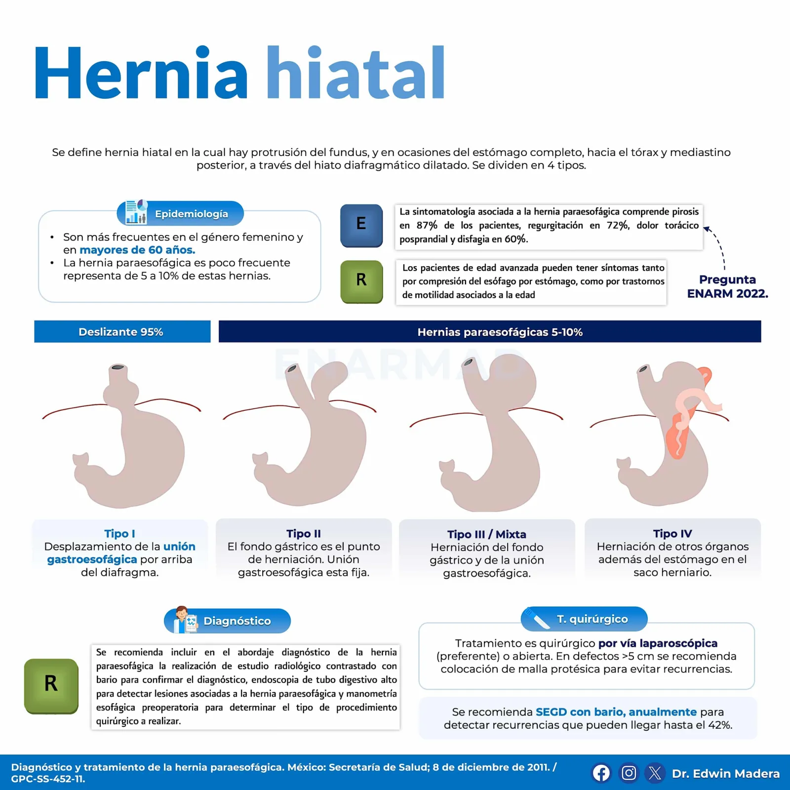 Hernia hiatal
