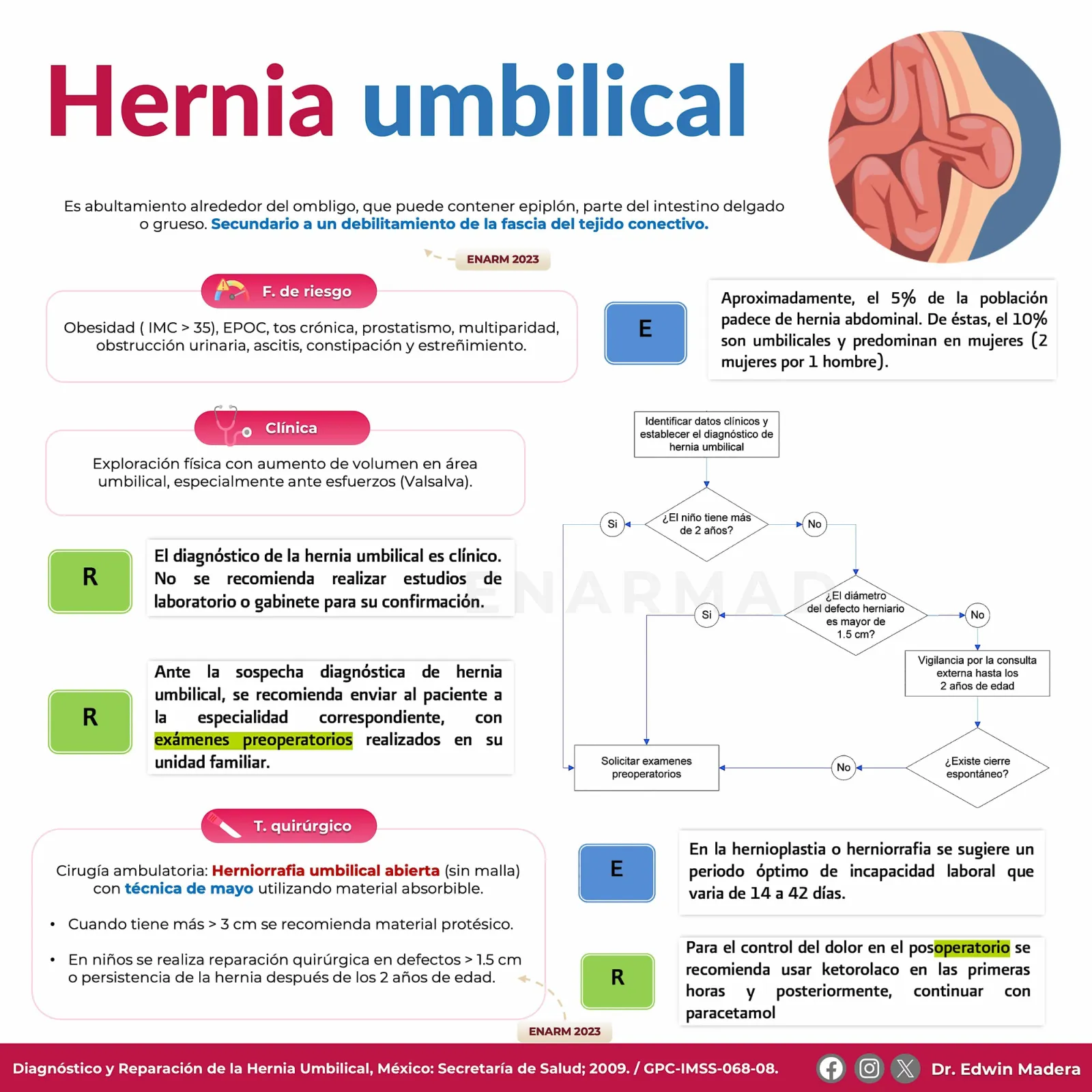 Hernia umbilical