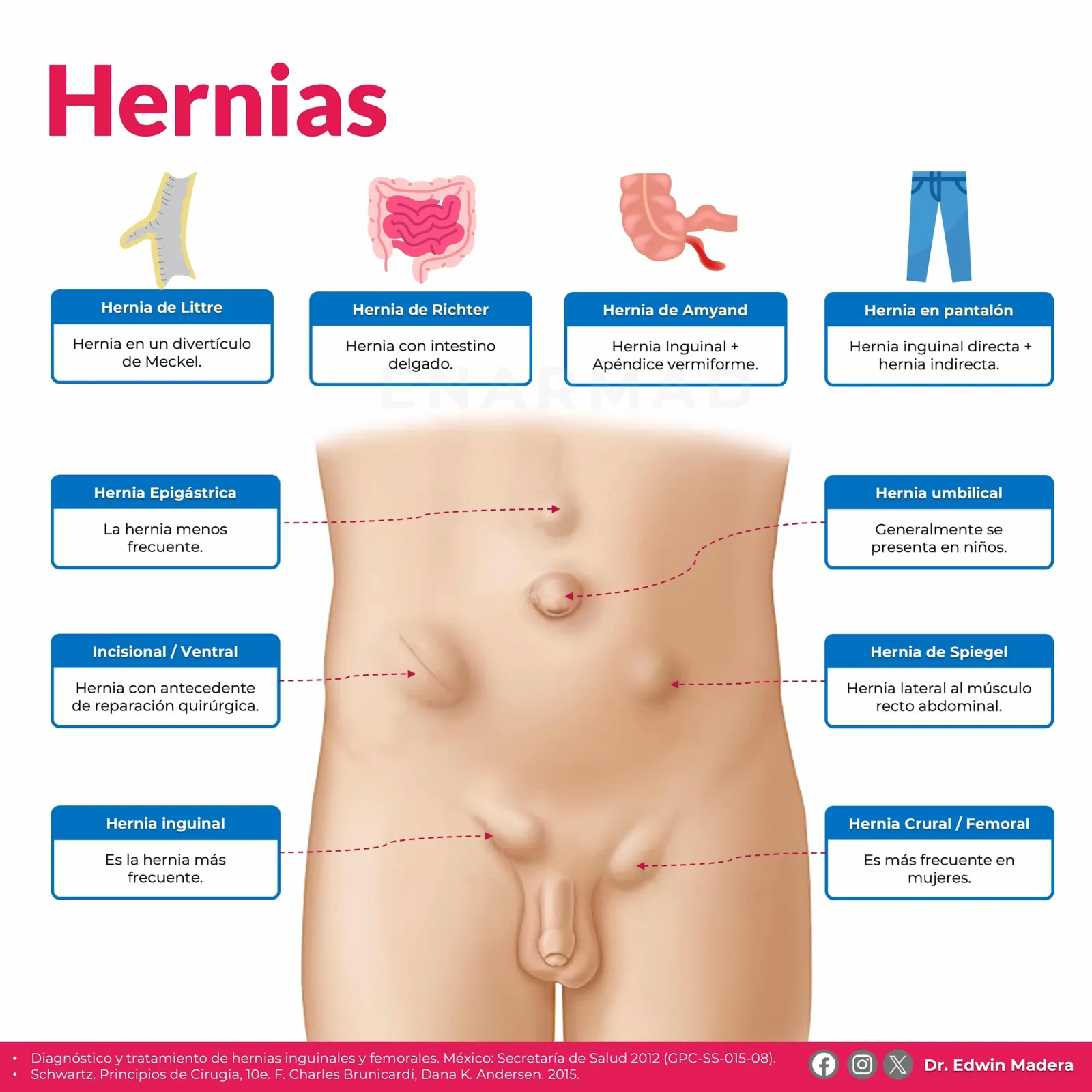 Hernias