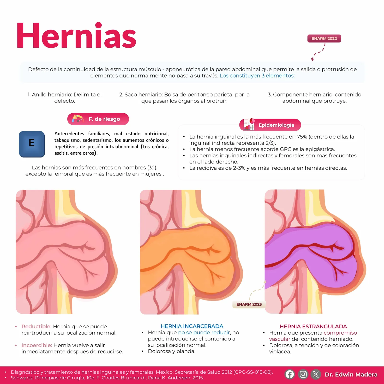 Hernias