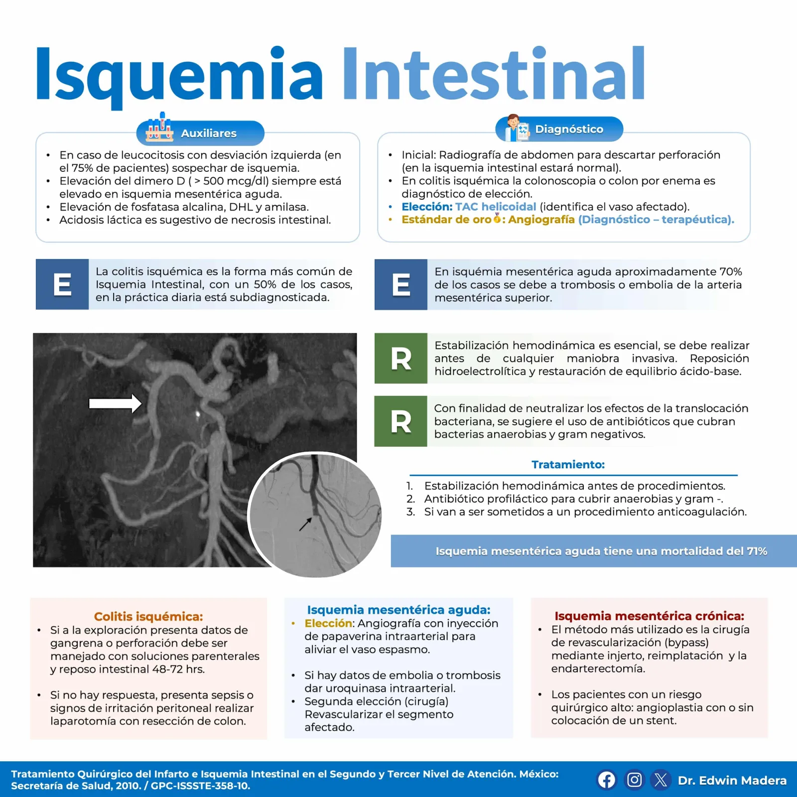 Isquemia intestinal
