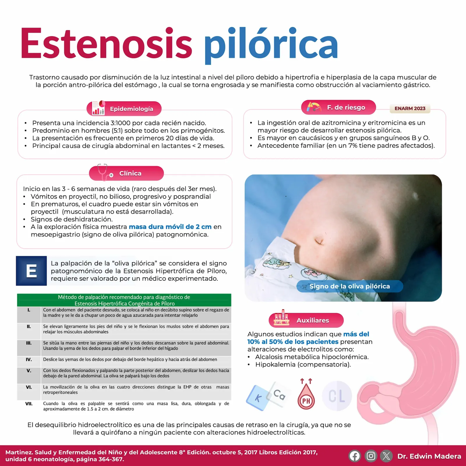 Estenosis pilórica