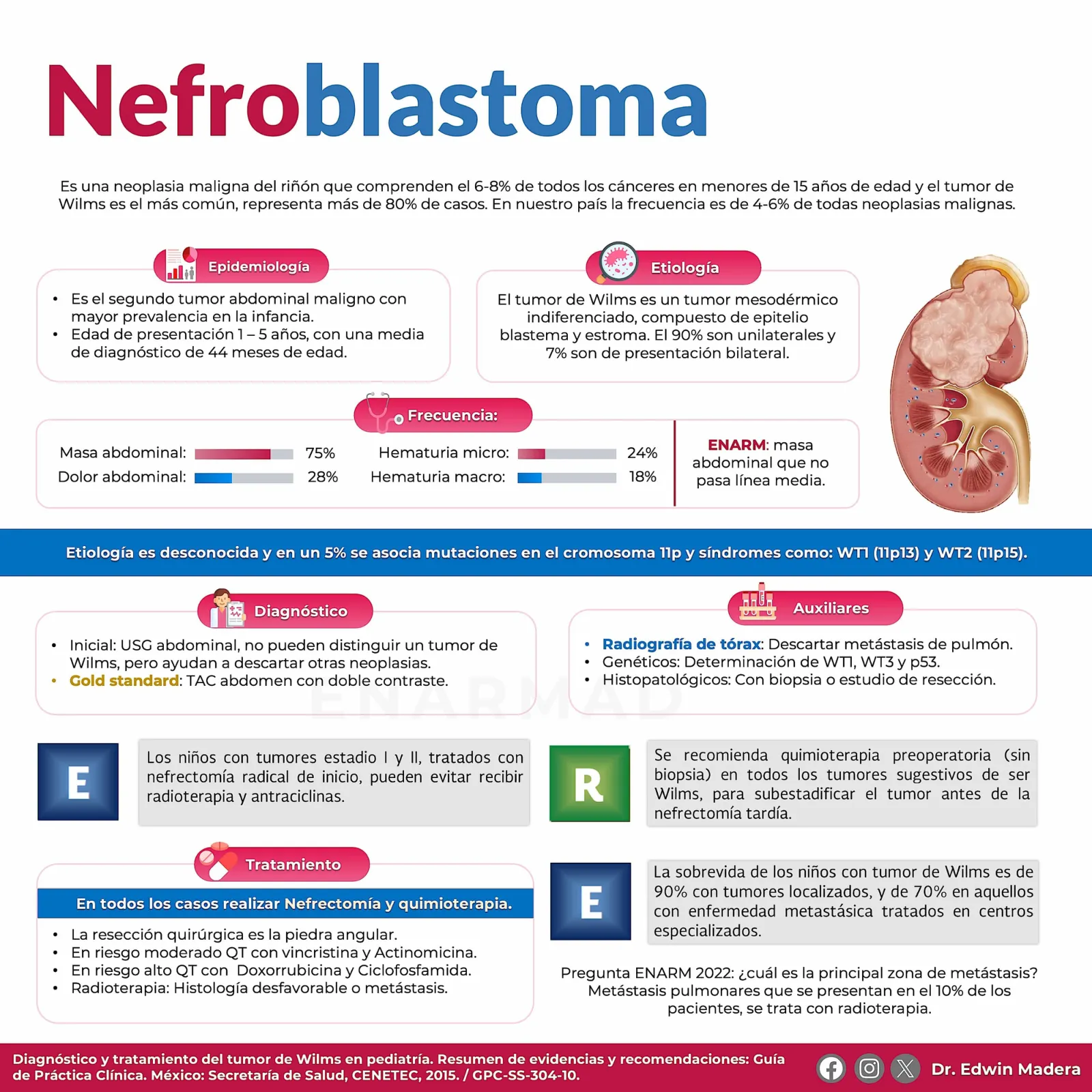 Nefroblastoma