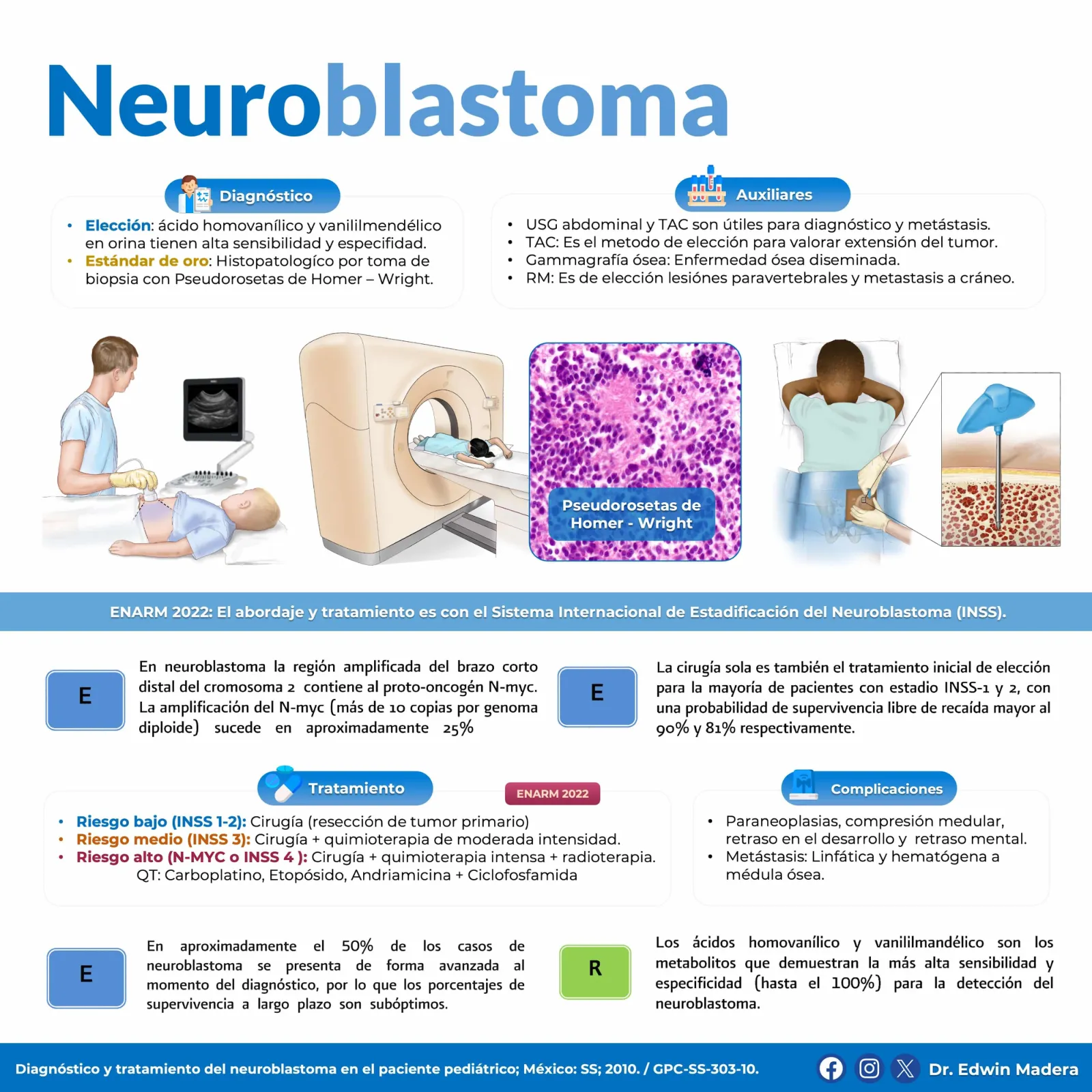 Neuroblastoma