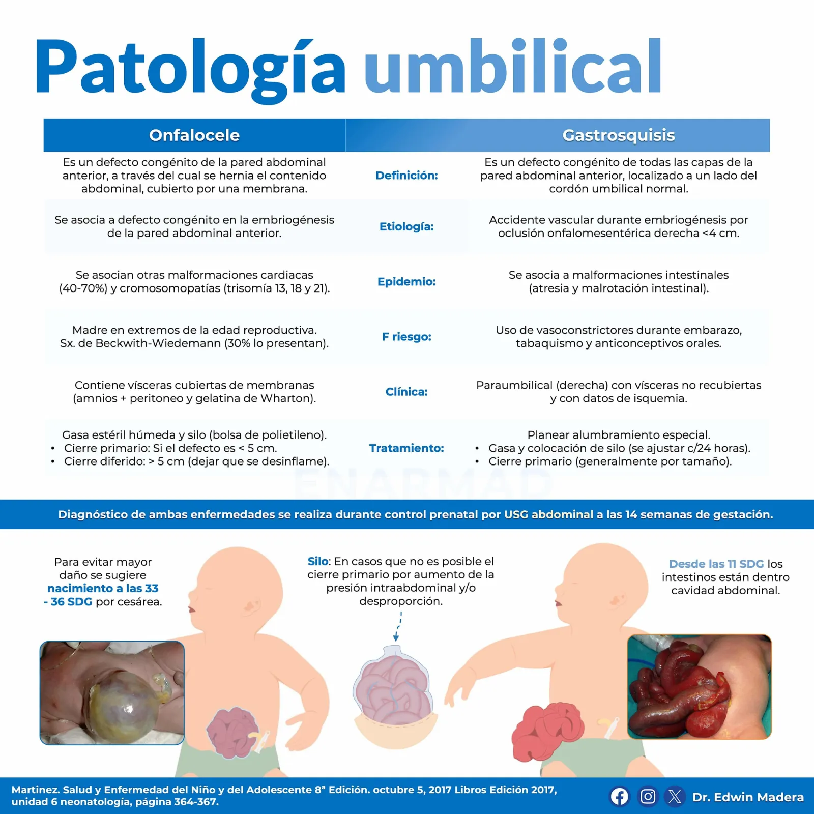 Patología umbilical