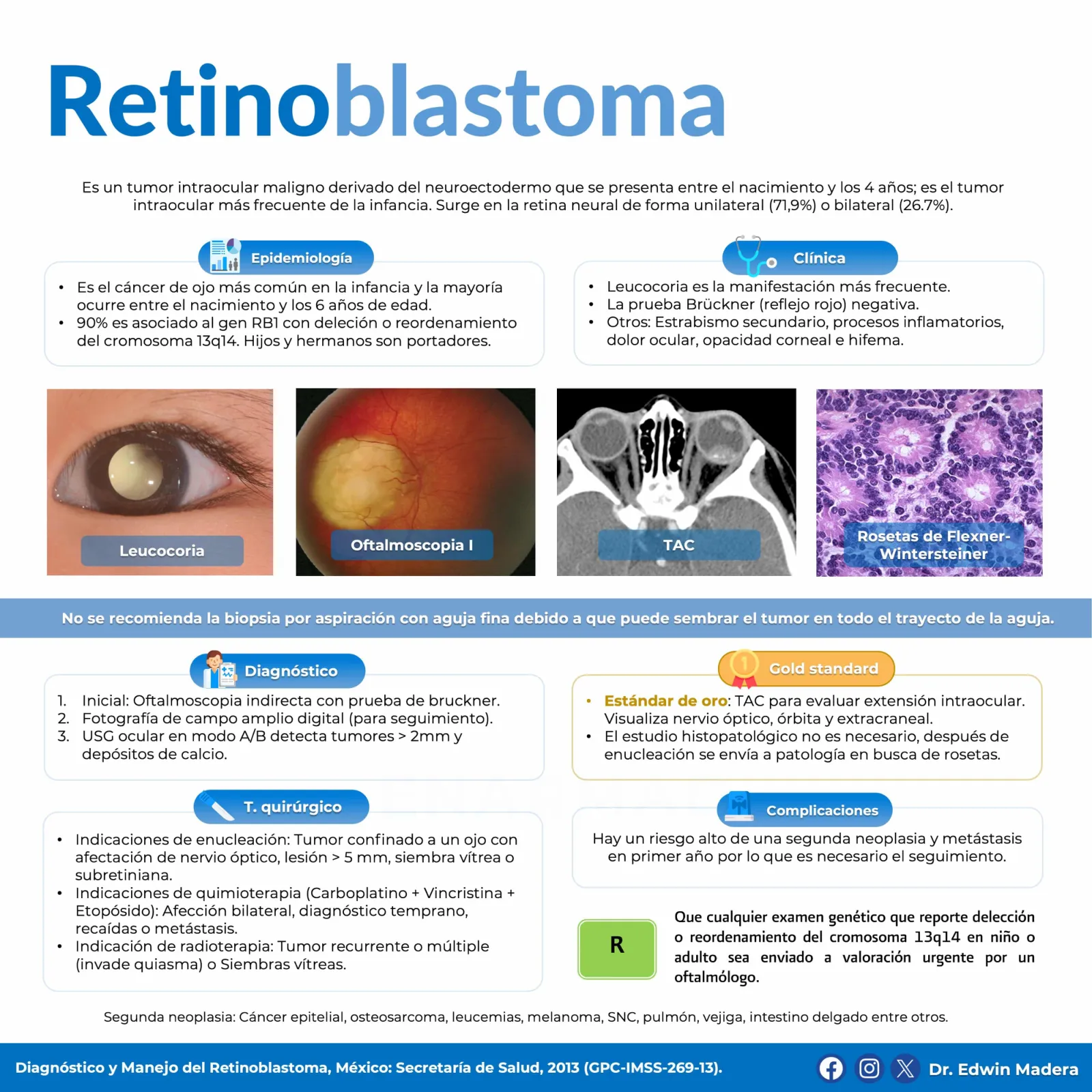 Retinoblastoma