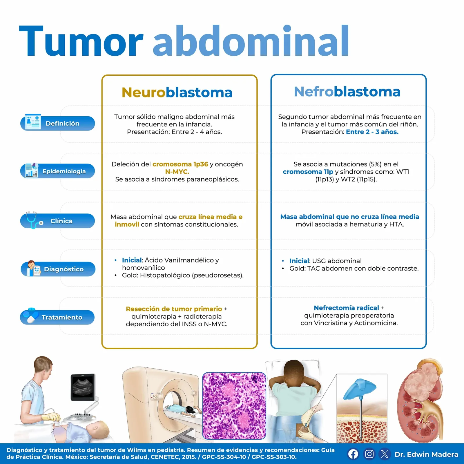 Tumor abdominal